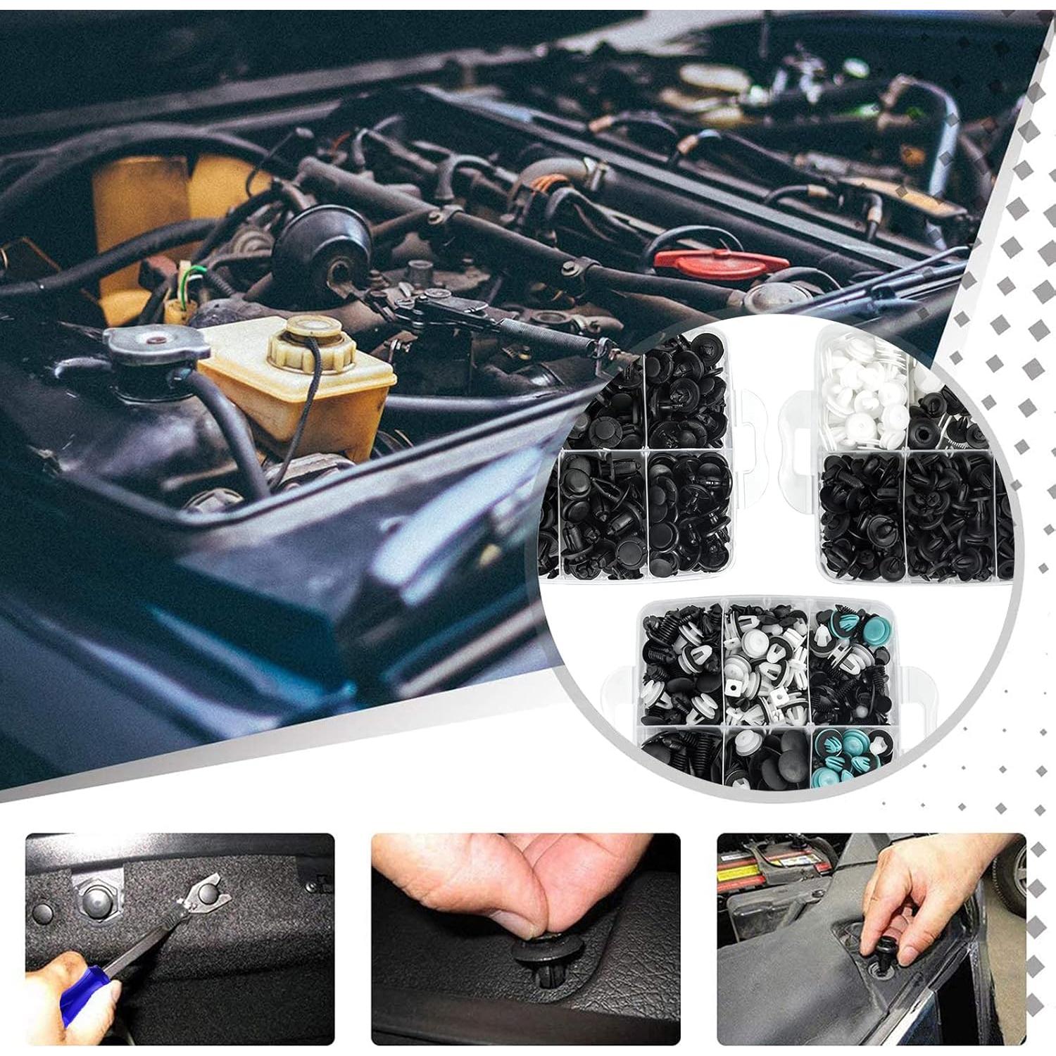 801 Clips de Retención para Auto UNENDA - Kit Universal con Removedor