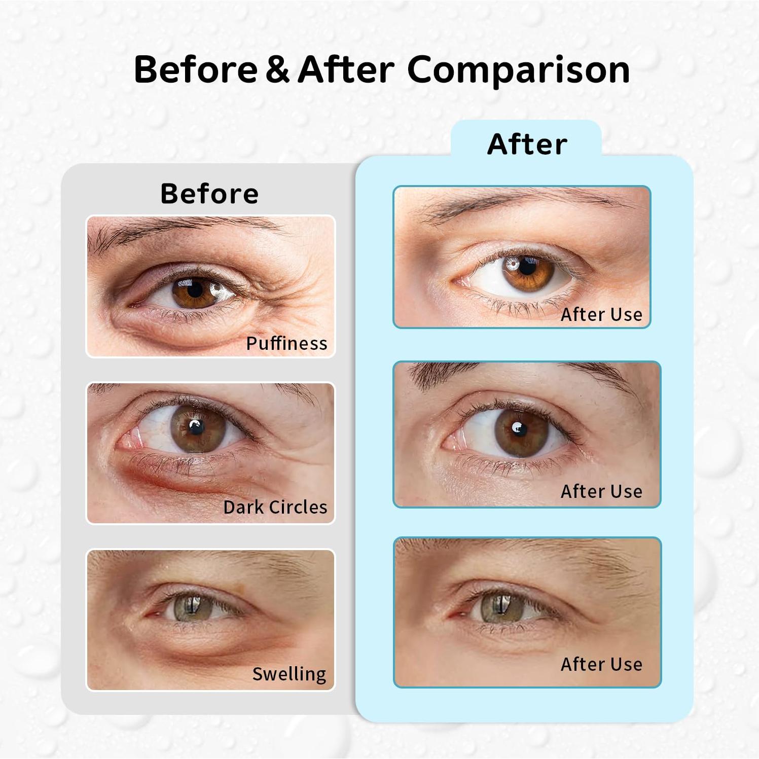 Almohadillas Reutilizables para Ojos CONBELLA - 2 Cangrejos + 2 Pandas