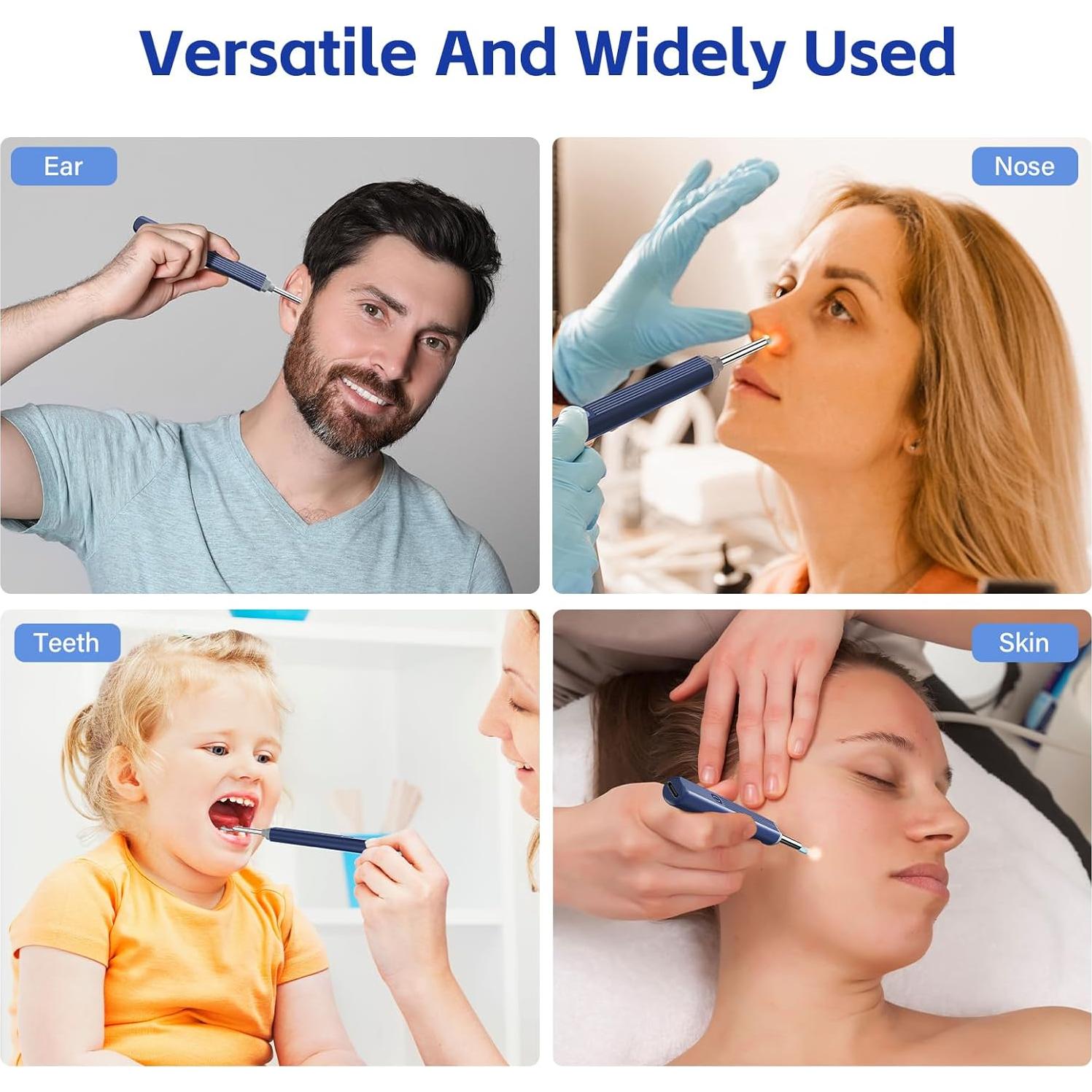 Kit de Limpieza de Oído Morelax con Cámara 1080P 8 Piezas