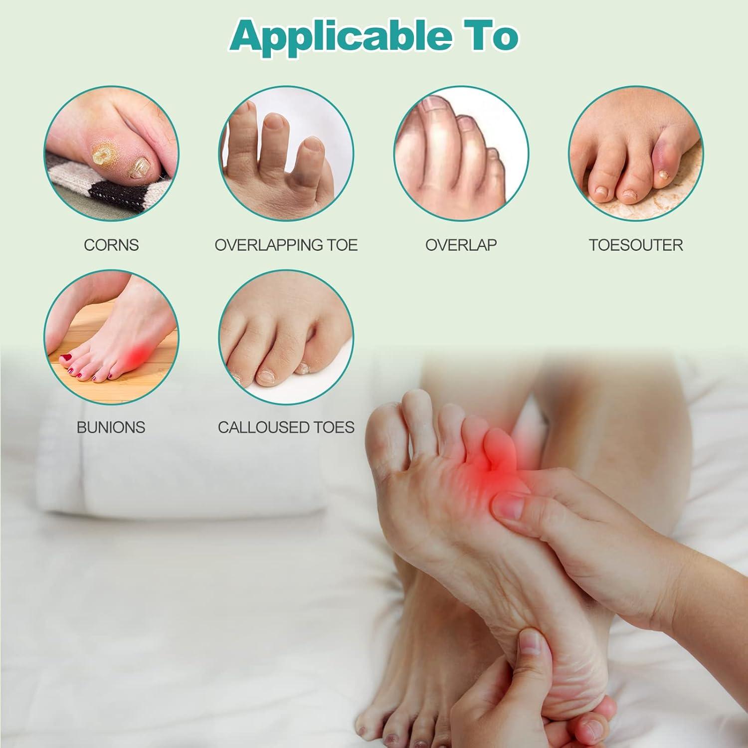 Corrector de Bunion de Sastre WooTshu - Almohadillas Antideslizantes
