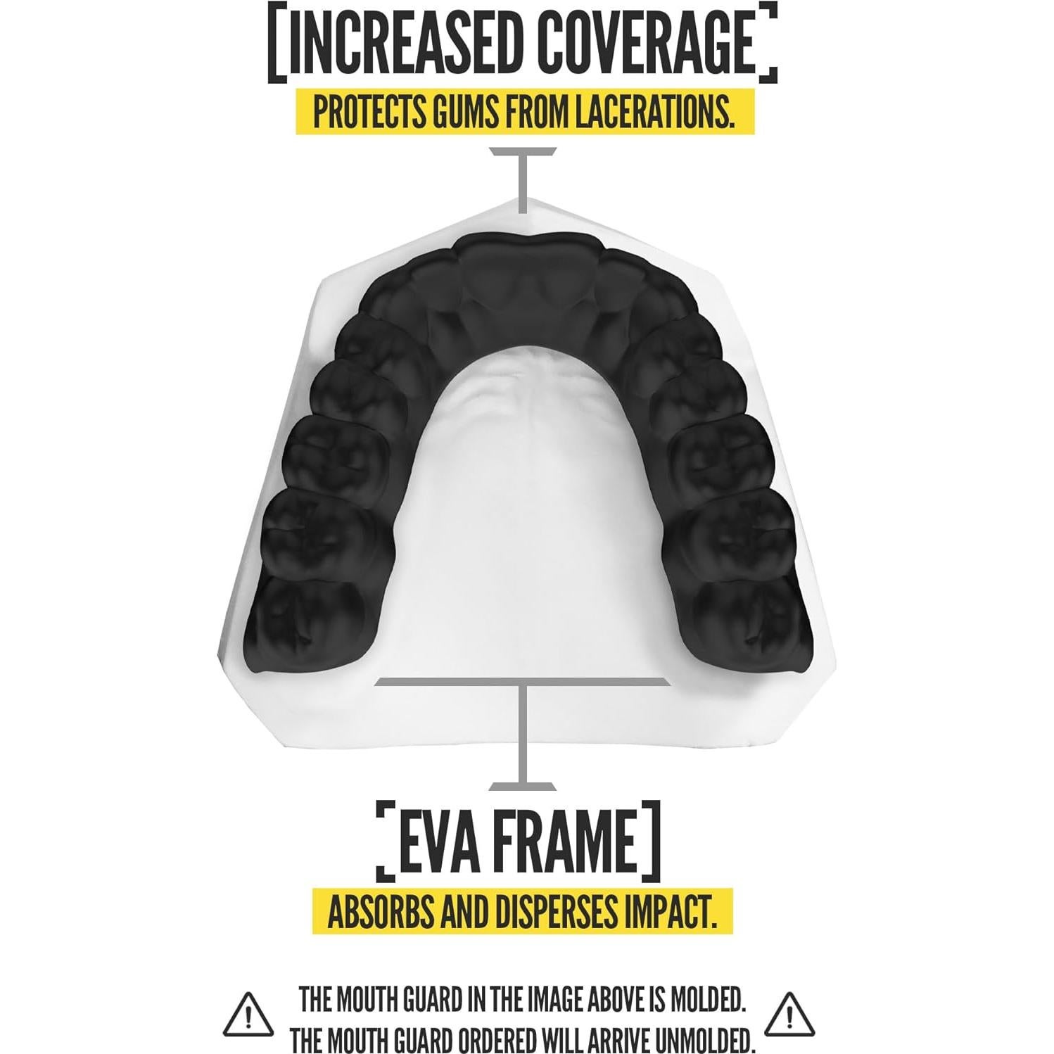 Protector Bucal NXTRND Classic - Paquete de 2 Unidades Negro