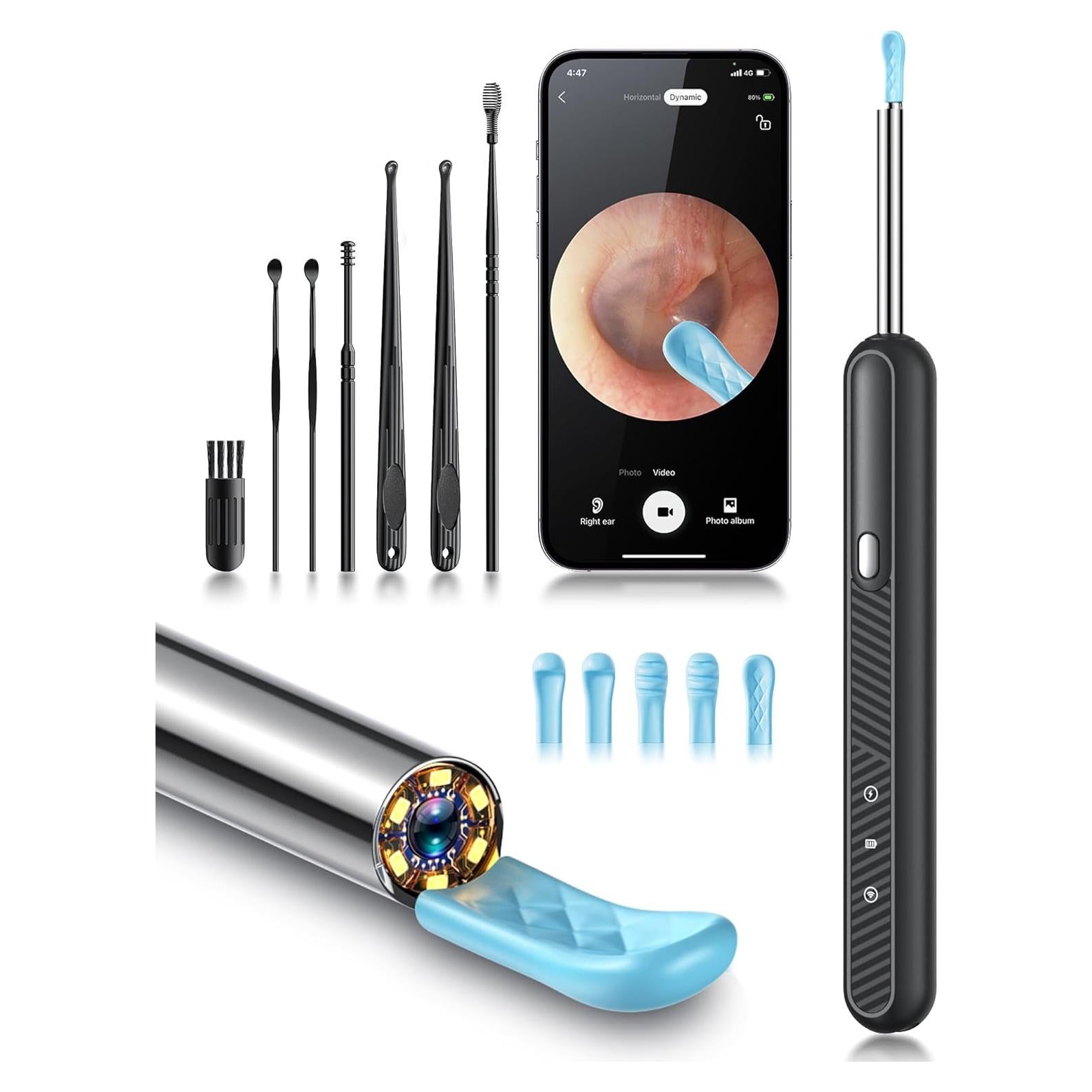 Herramienta de Eliminación de Cerumen Loyker con Cámara 1080P