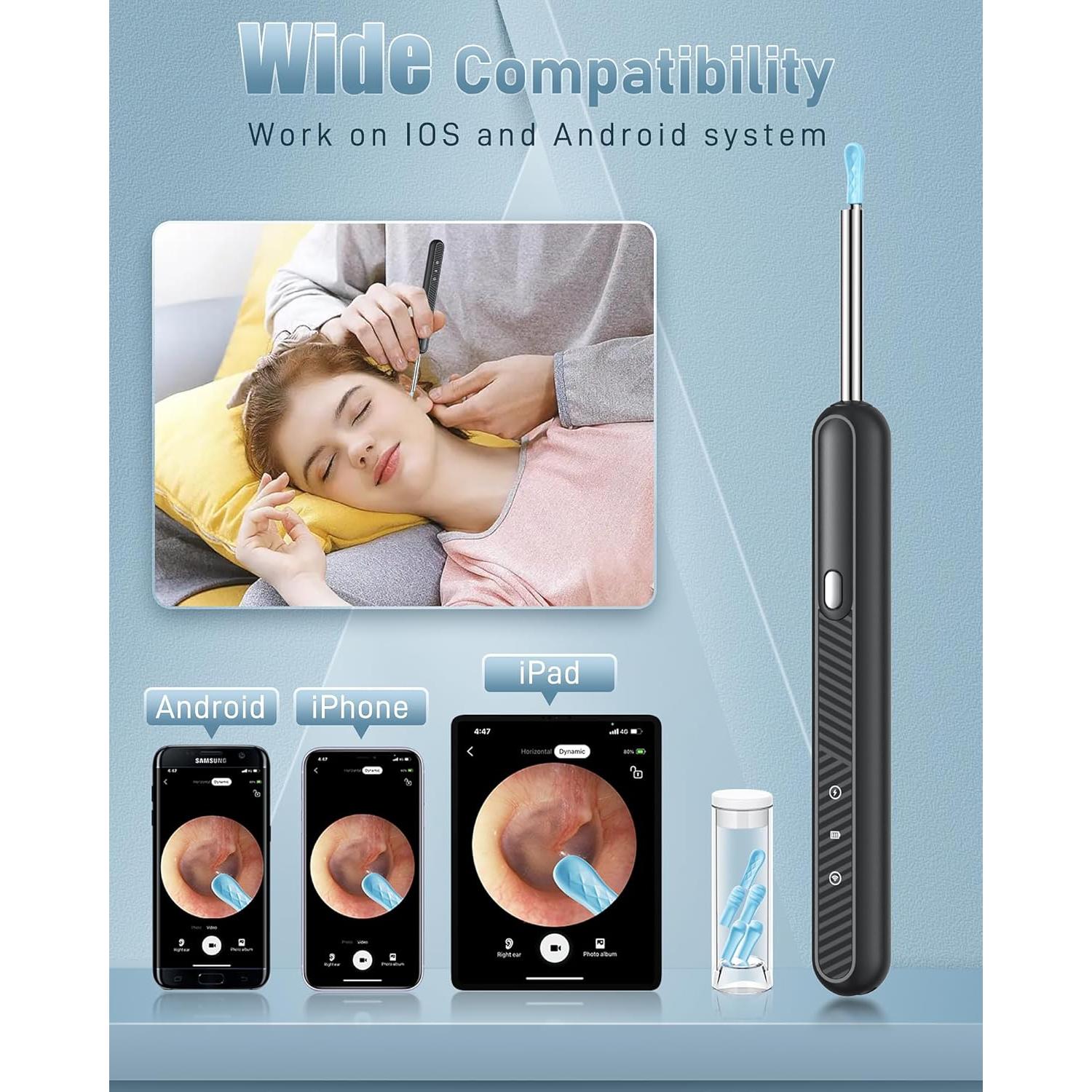 Herramienta de Eliminación de Cerumen Loyker con Cámara 1080P