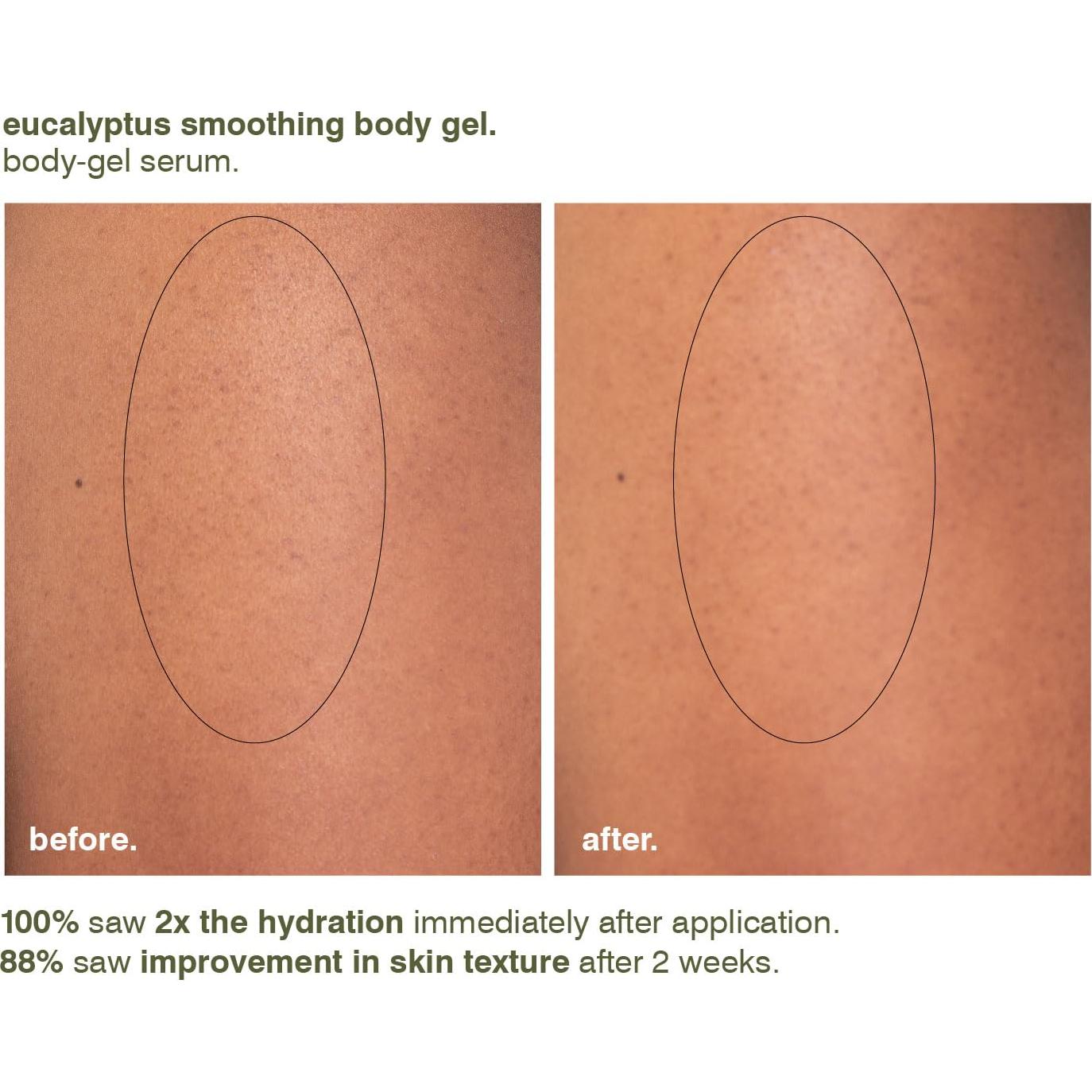 Gel Corporal Suavizante Eucalipto MALIN+GOETZ 221g Vegano