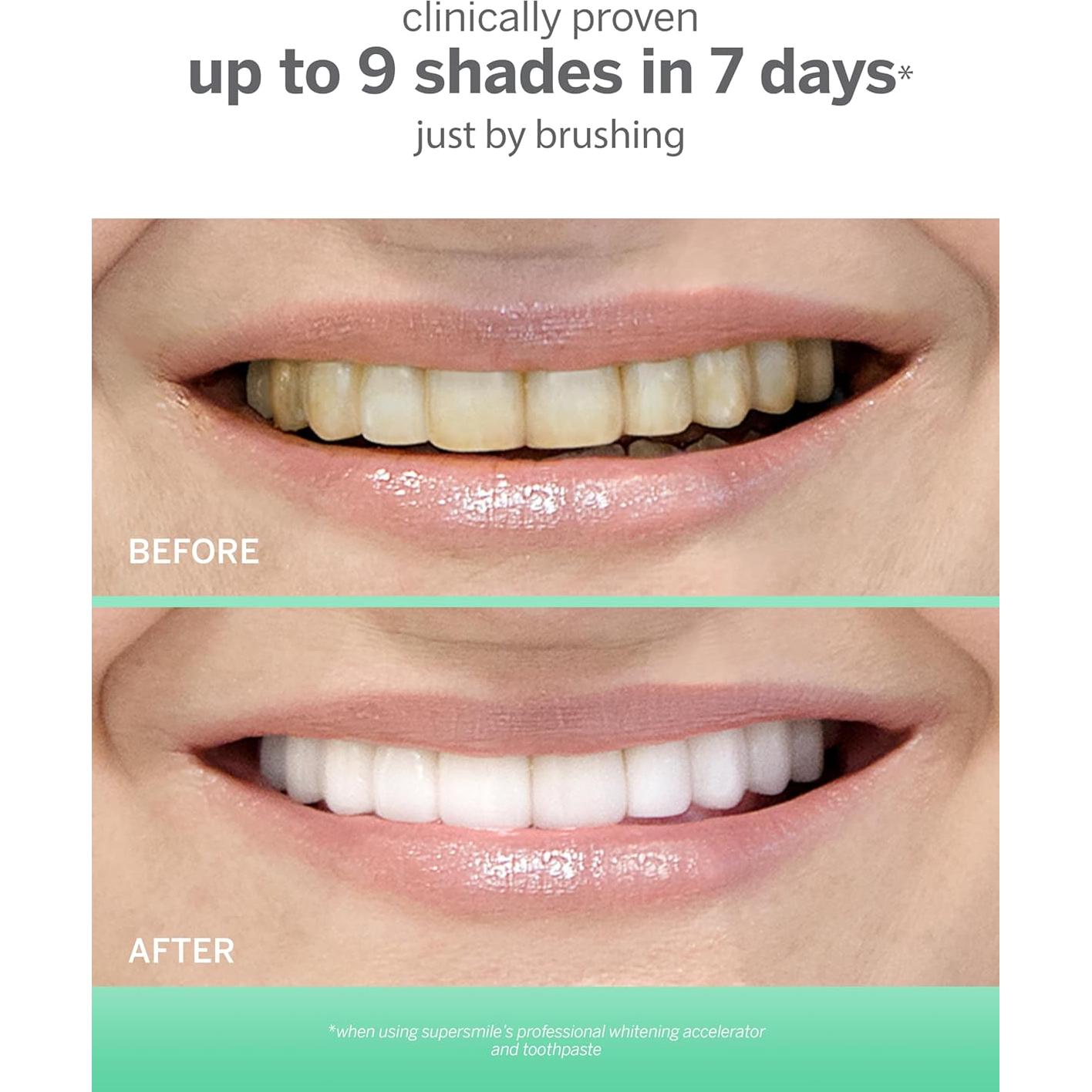 Gel Blanqueador Supersmile 198 g - Acelerador Profesional