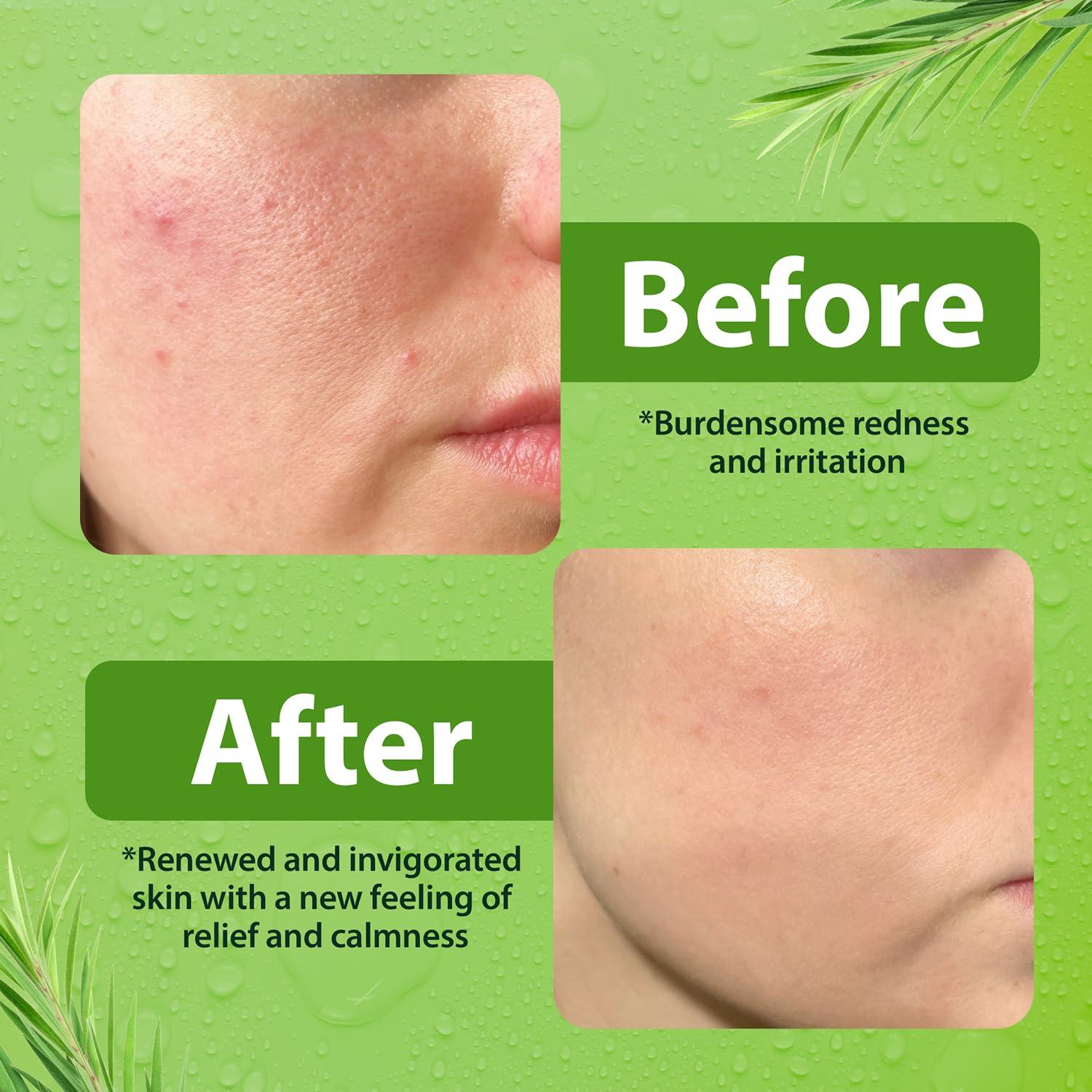 Limpiador Facial Suave Derma-nu 226.8g para Piel Sensible