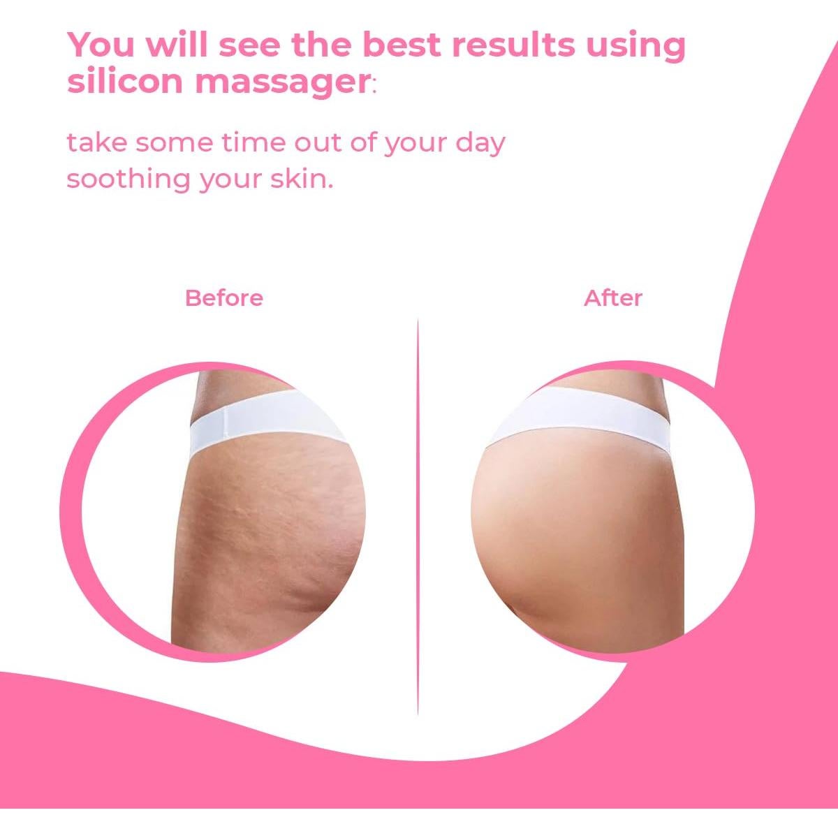 Rodillo Masajeador Anticelulitis Avalon 13.68x9.60cm