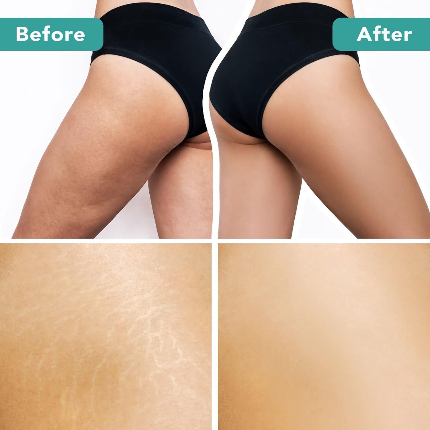 Cepillo Corporal Beauty By Earth Redondo Exfoliante Natural