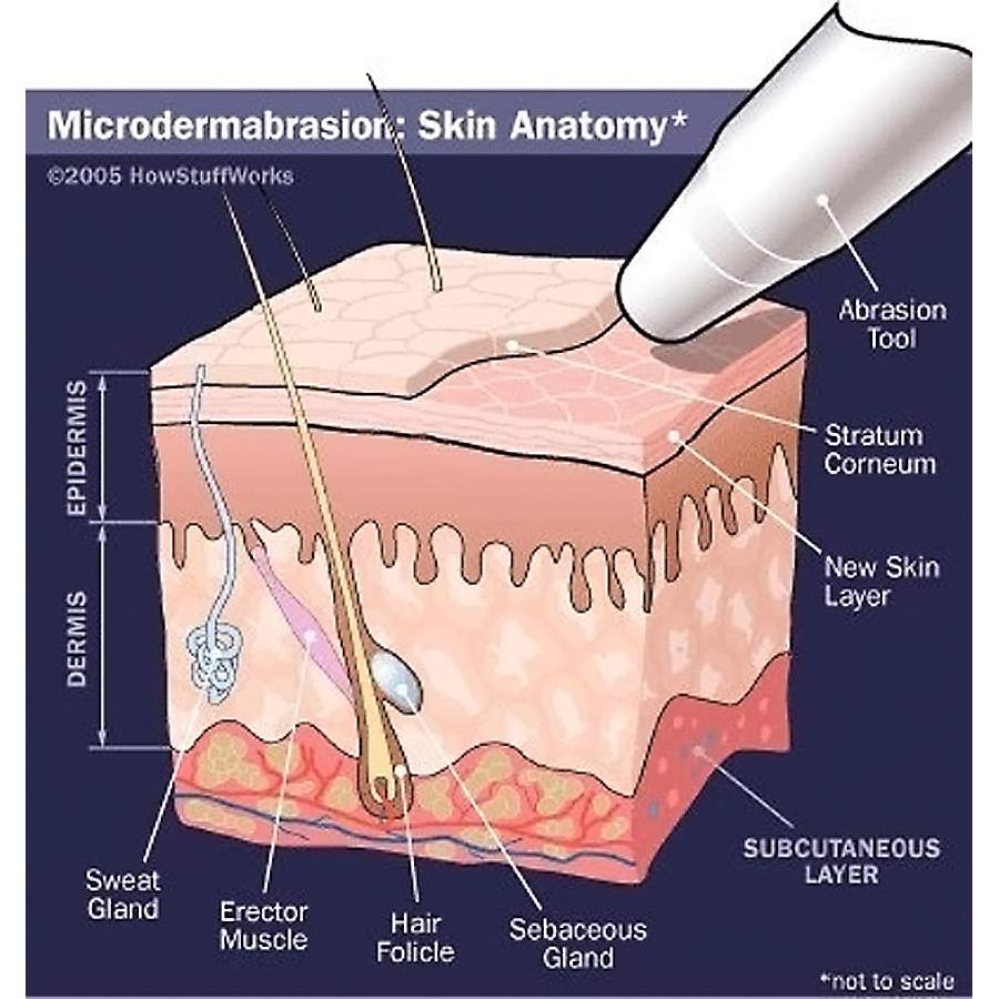 Cristales de Microdermoabrasión NeedCrystals 1.81 kg 100 Grit