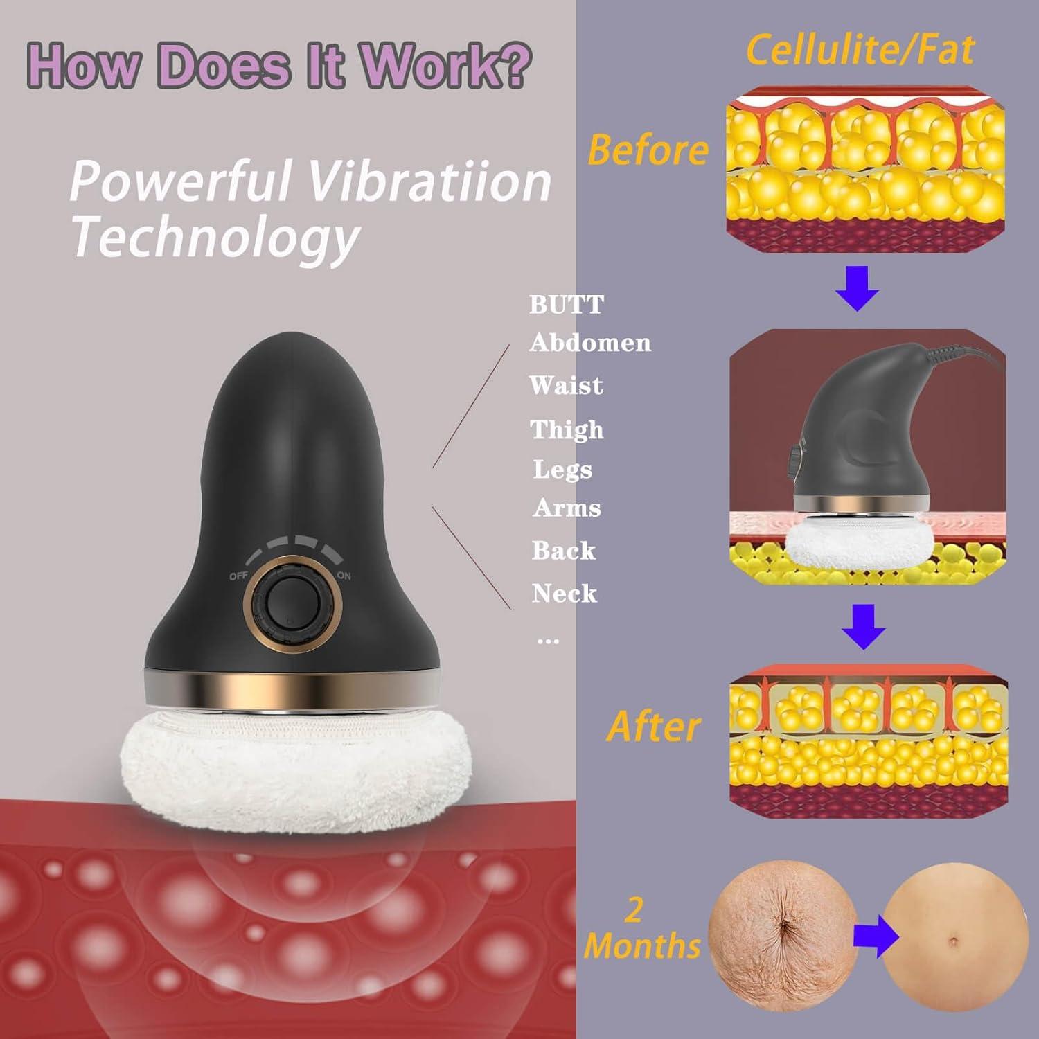 Masajeador de Celulitis DS SAVORING PL675-HJ 15.8x9.5cm