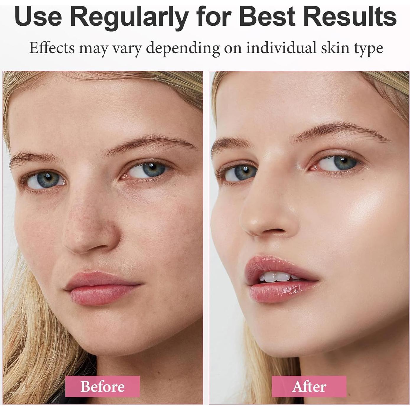 Mascarilla Facial ULLUXE de Colágeno Hidrogel Nocturna 4 Pzas