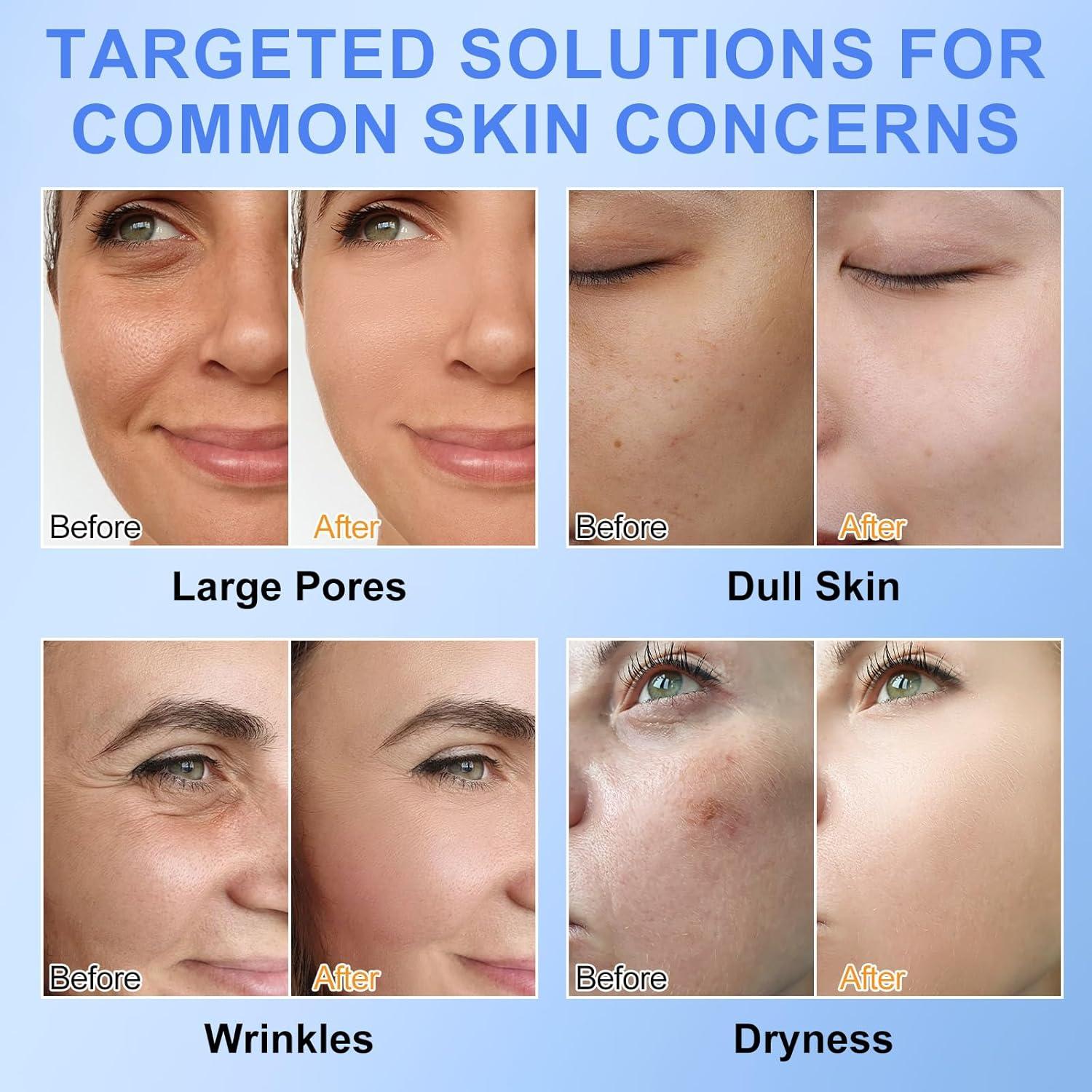 Mascarilla Facial de Colágeno Writheion 6 Piezas Hidratante