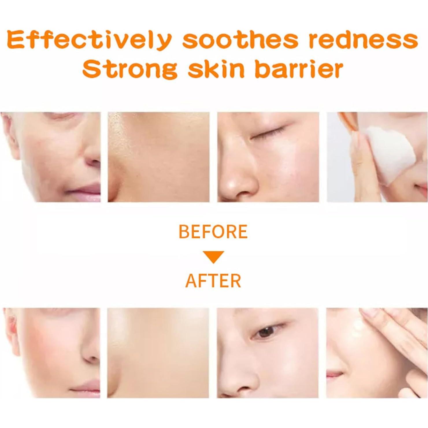 Mascarillas de colágeno MELEELL 36 paquetes hidratantes