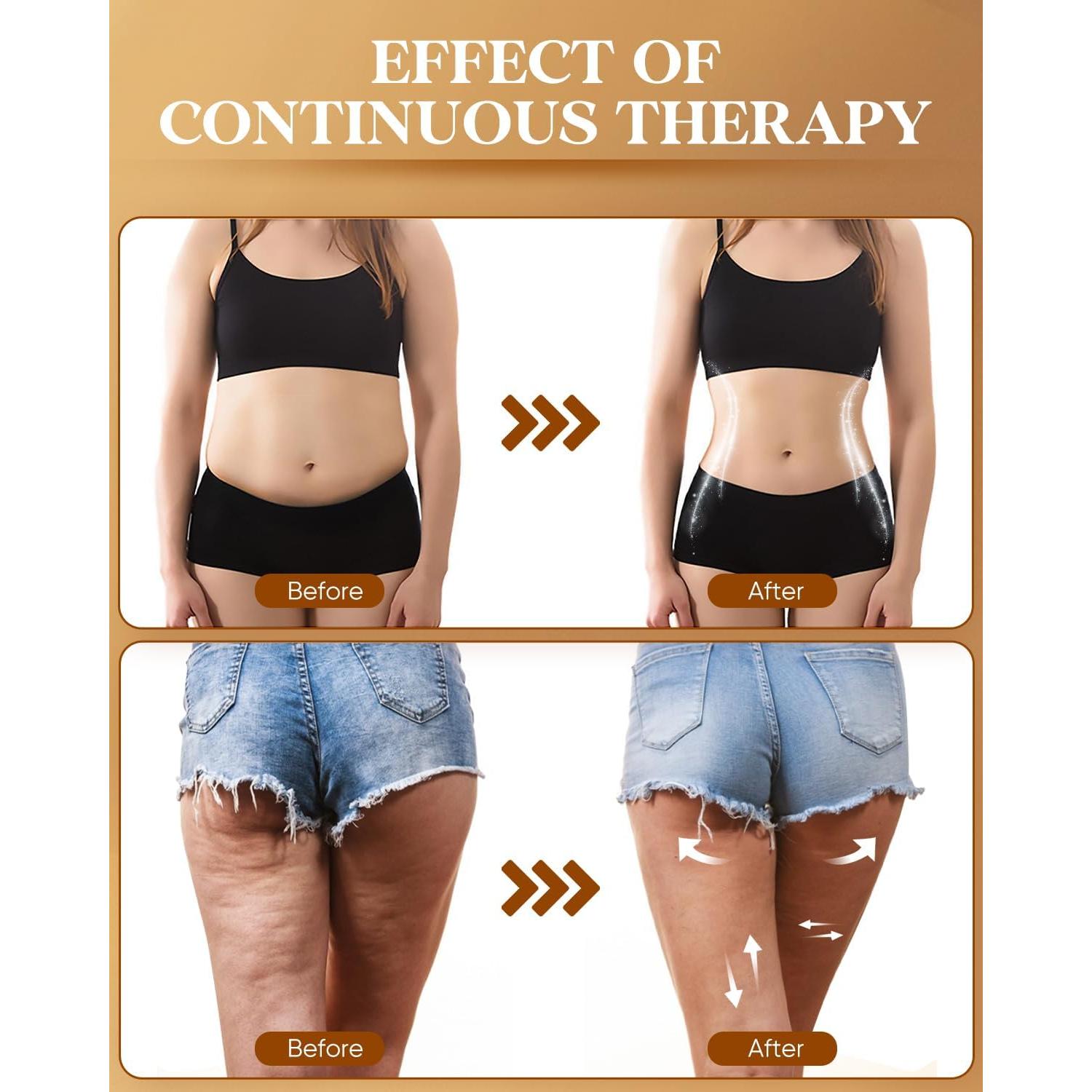 Masajeador de Madera ONUEMP para Celulitis y Drenaje