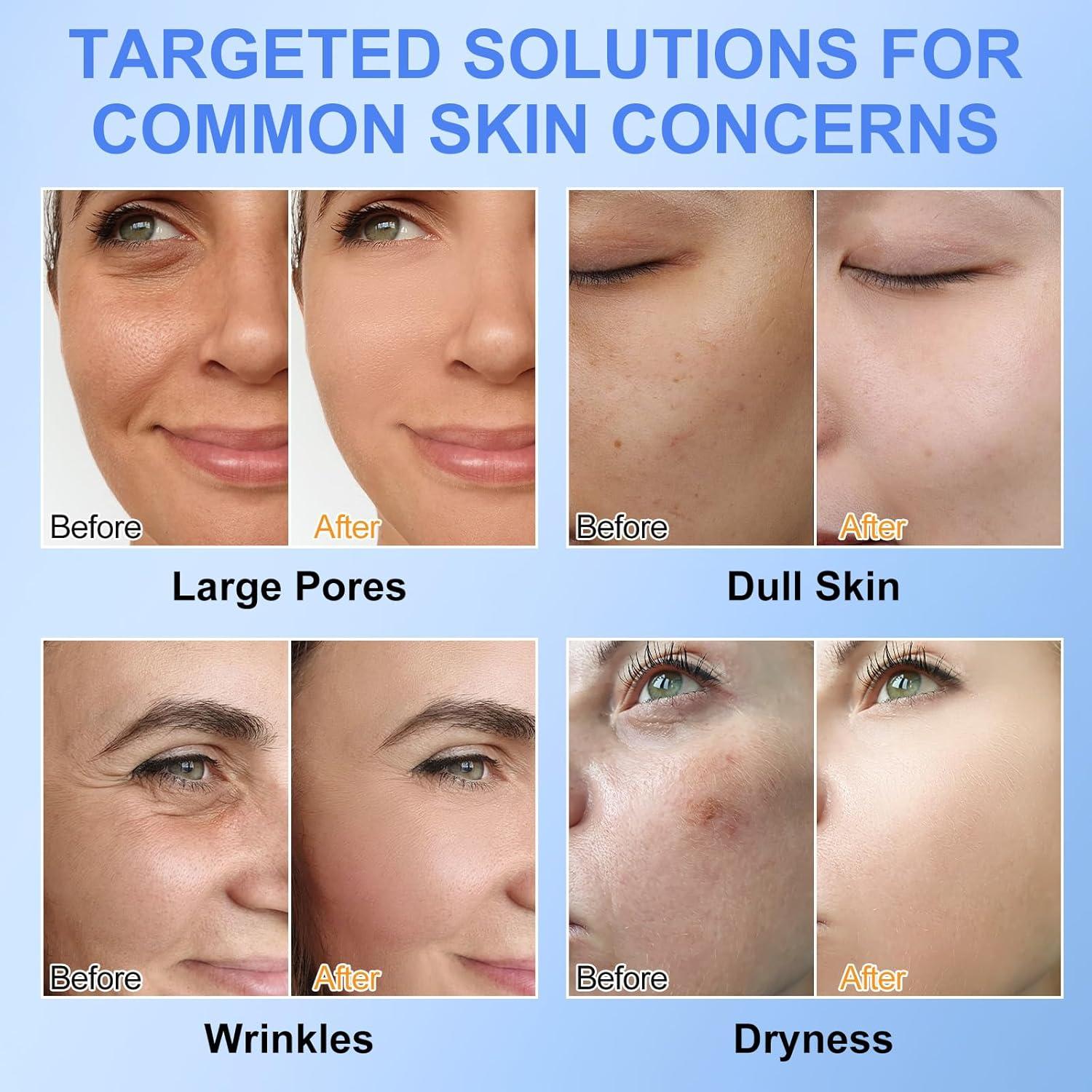 Mascarilla Facial de Colágeno Akeeronn 6 Pcs Hidratante