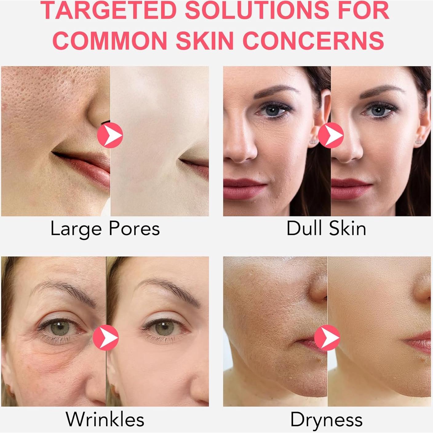 Mascarilla Hidratante IDUCEN con Colágeno y Probioticos 4 Pzas