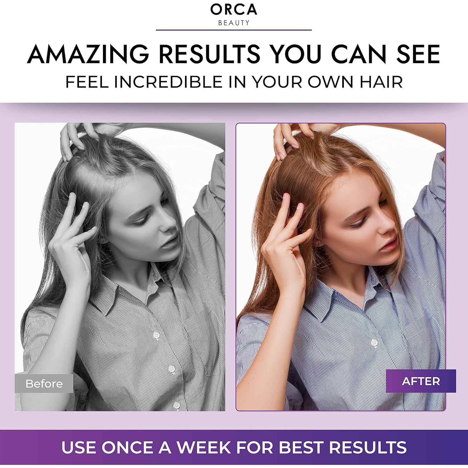 Set Champú y Acondicionador Biotina Orca Beauty 226g