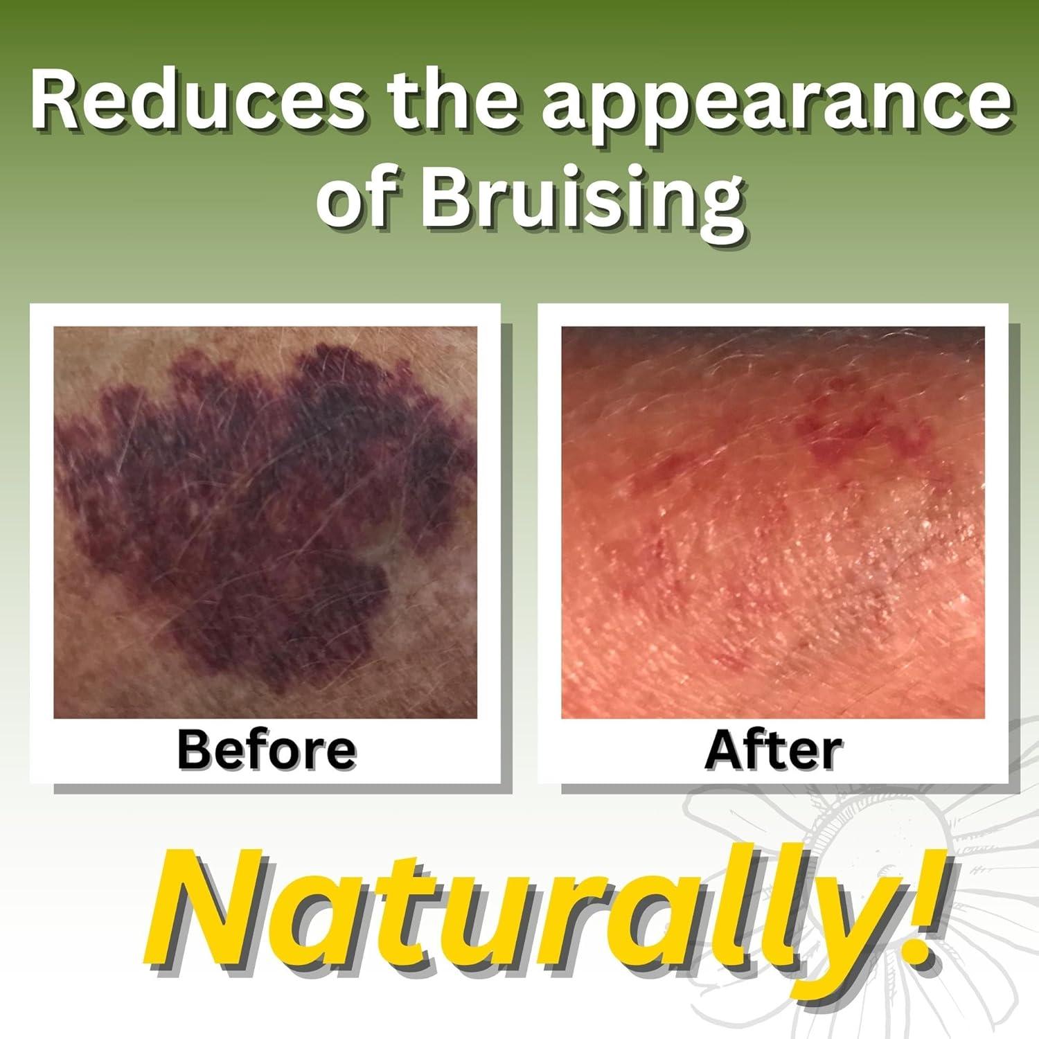 Aceite de Masaje Arnica Relief 473ml Natural para Alivio