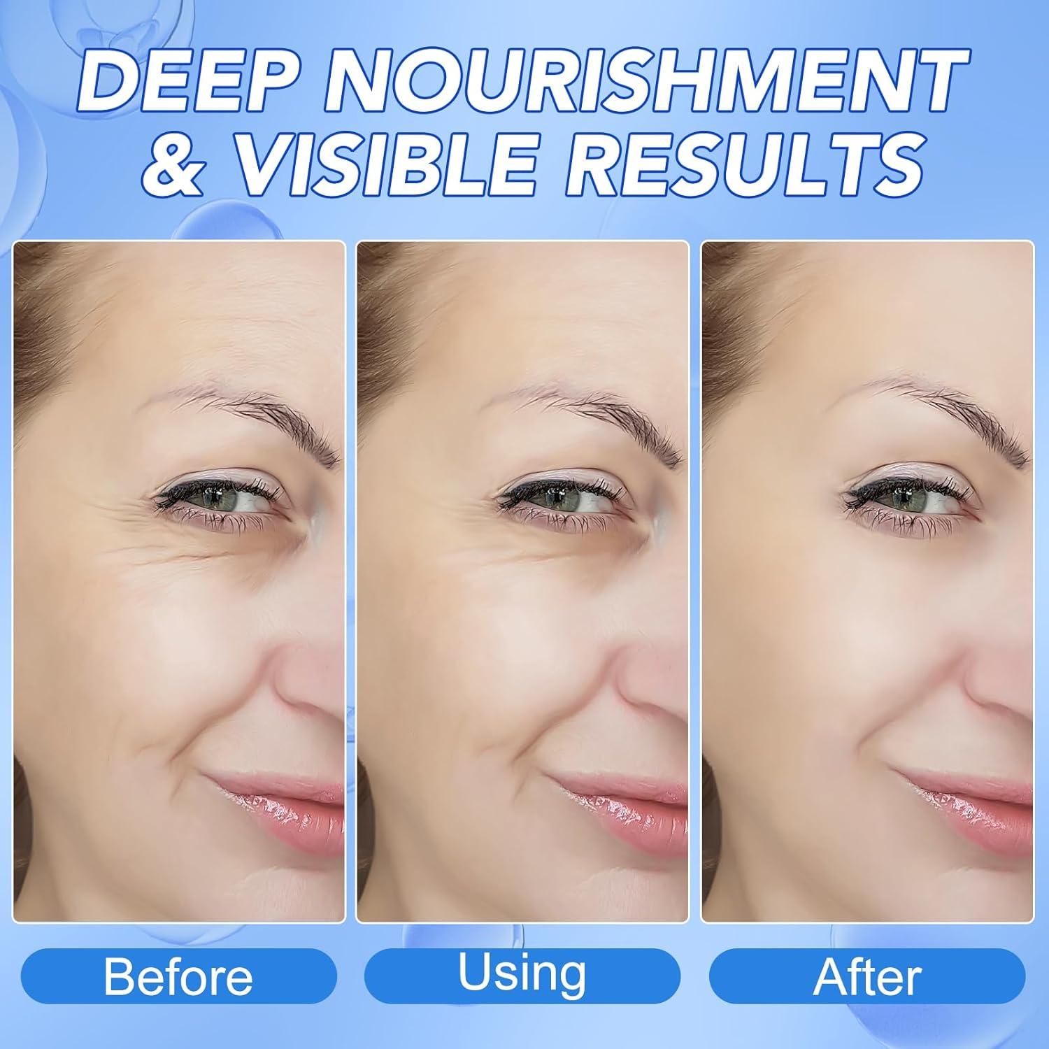 Mascarilla Facial Hidratante de Colágeno GOGIFTGO 34g x 4ea