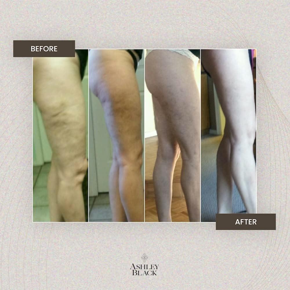 Mini 2 Ashley Black - Herramienta para celulitis y masaje