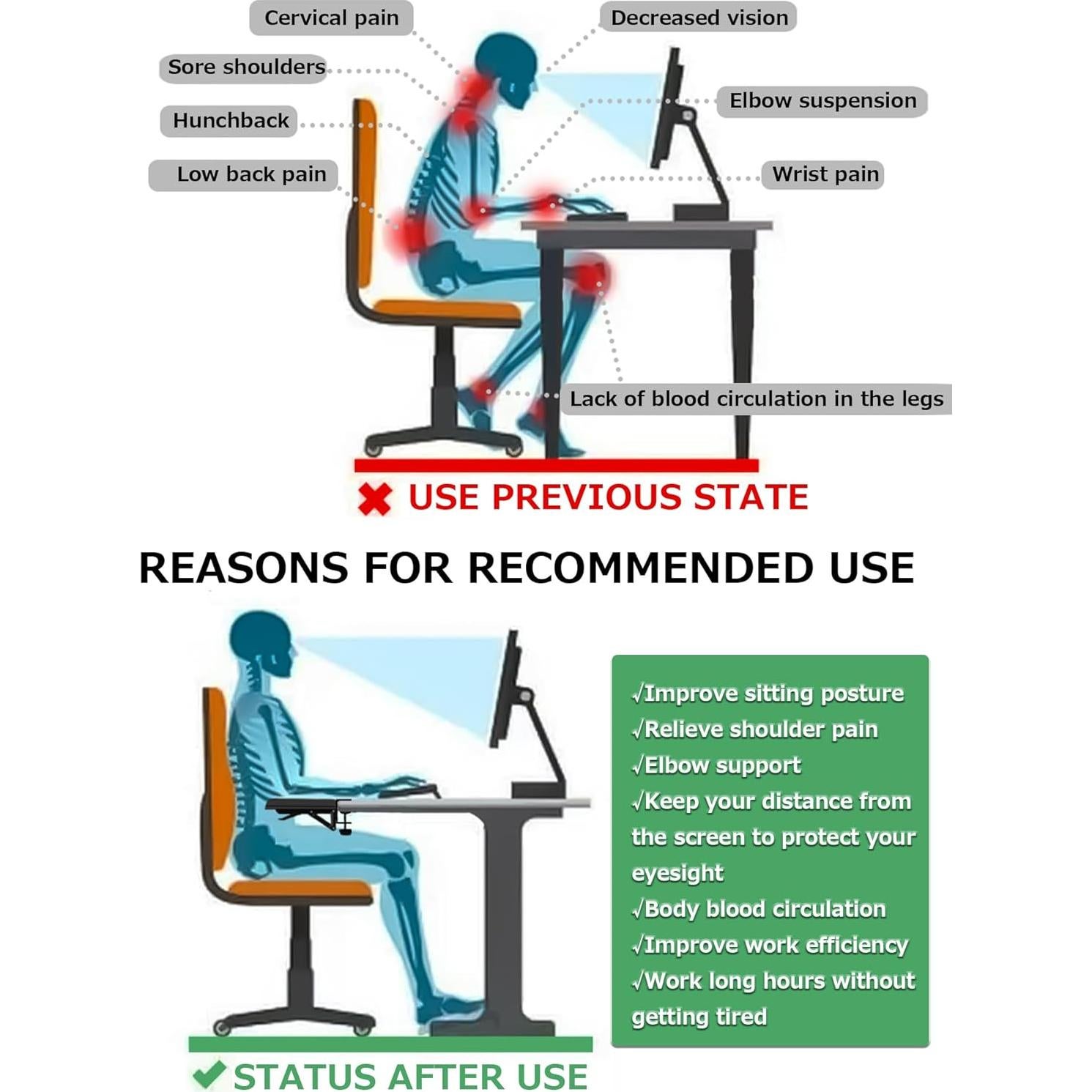 Reposabrazos Ergonómico NODOCA para Escritorio Plegable 1 pieza