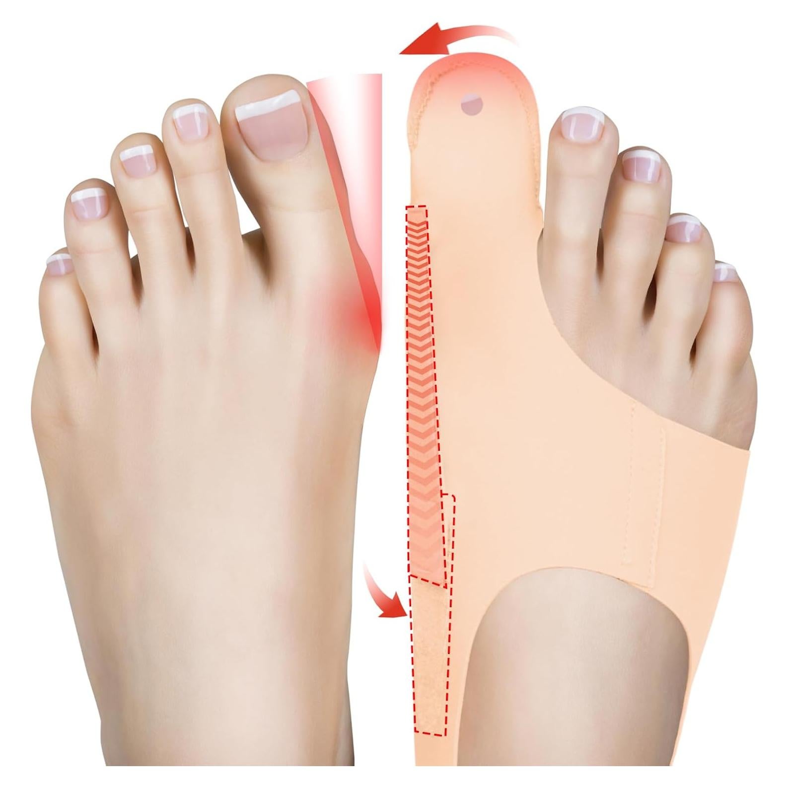 Corrector de Juanetes Apouni Mediano - Alivio Valgus Dedo Gordo