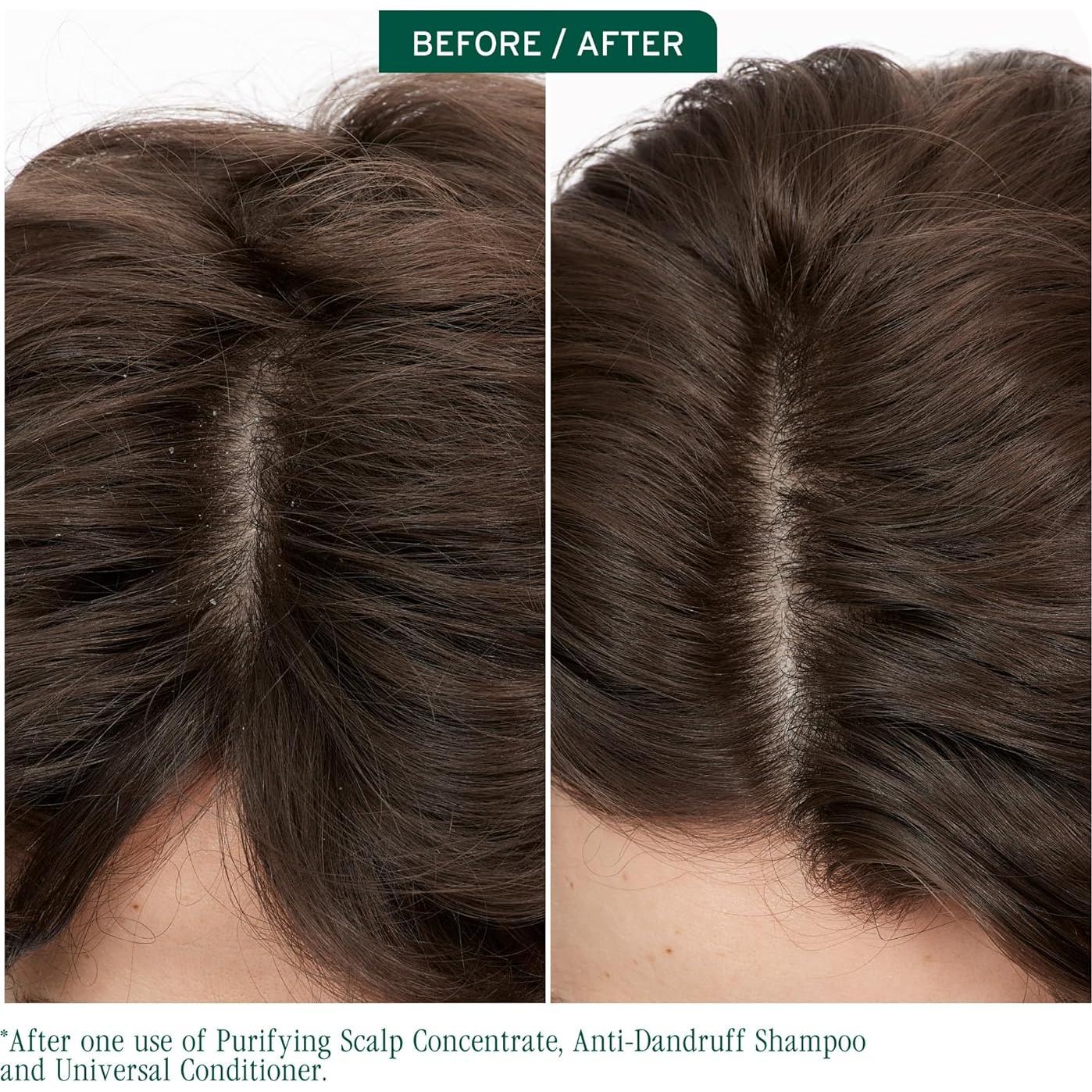 Champú Anticaspa Biolage Scalp Sync 50 ml - Vegano y Eficaz