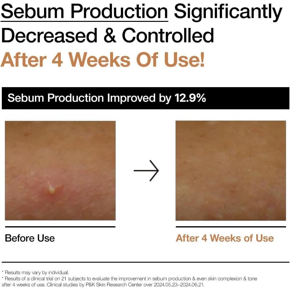 Tónico Lechoso ANUA Rice 70 Glow 250ml Hidratante Piel