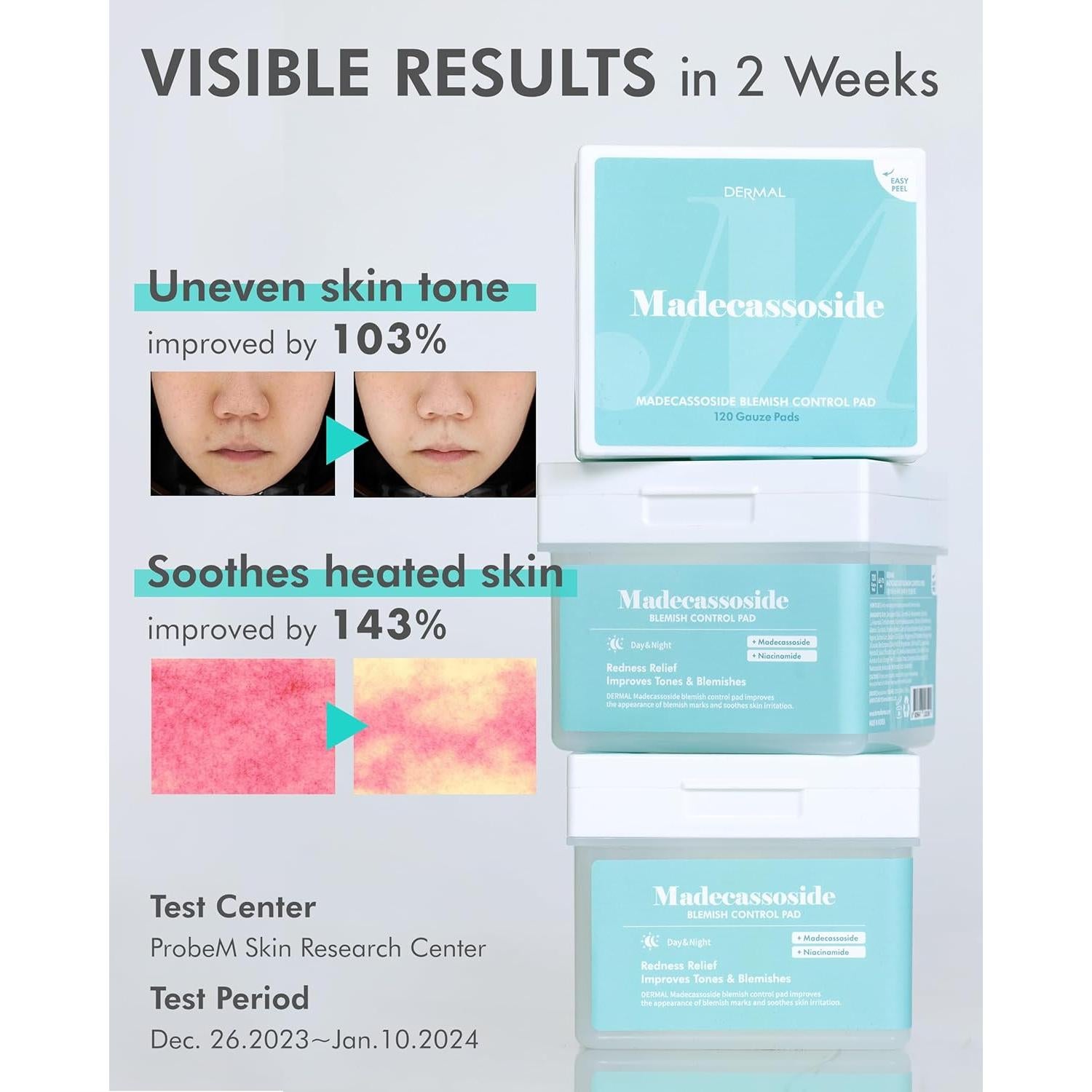 Almohadillas Tónicas Dermal Madecassoside - 120 Hojas Veganas