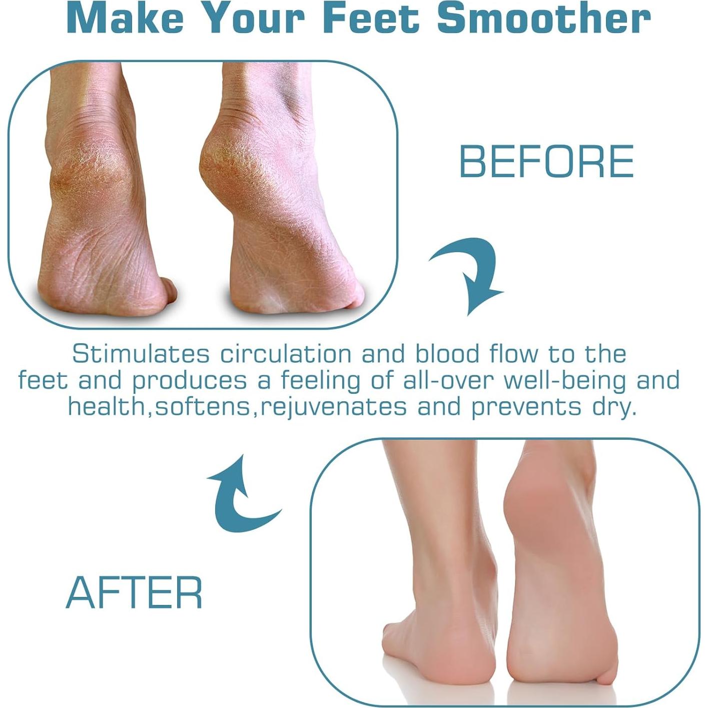 Alfombrilla Exfoliante para Pies SZZYXD con Ventosas 25x15cm