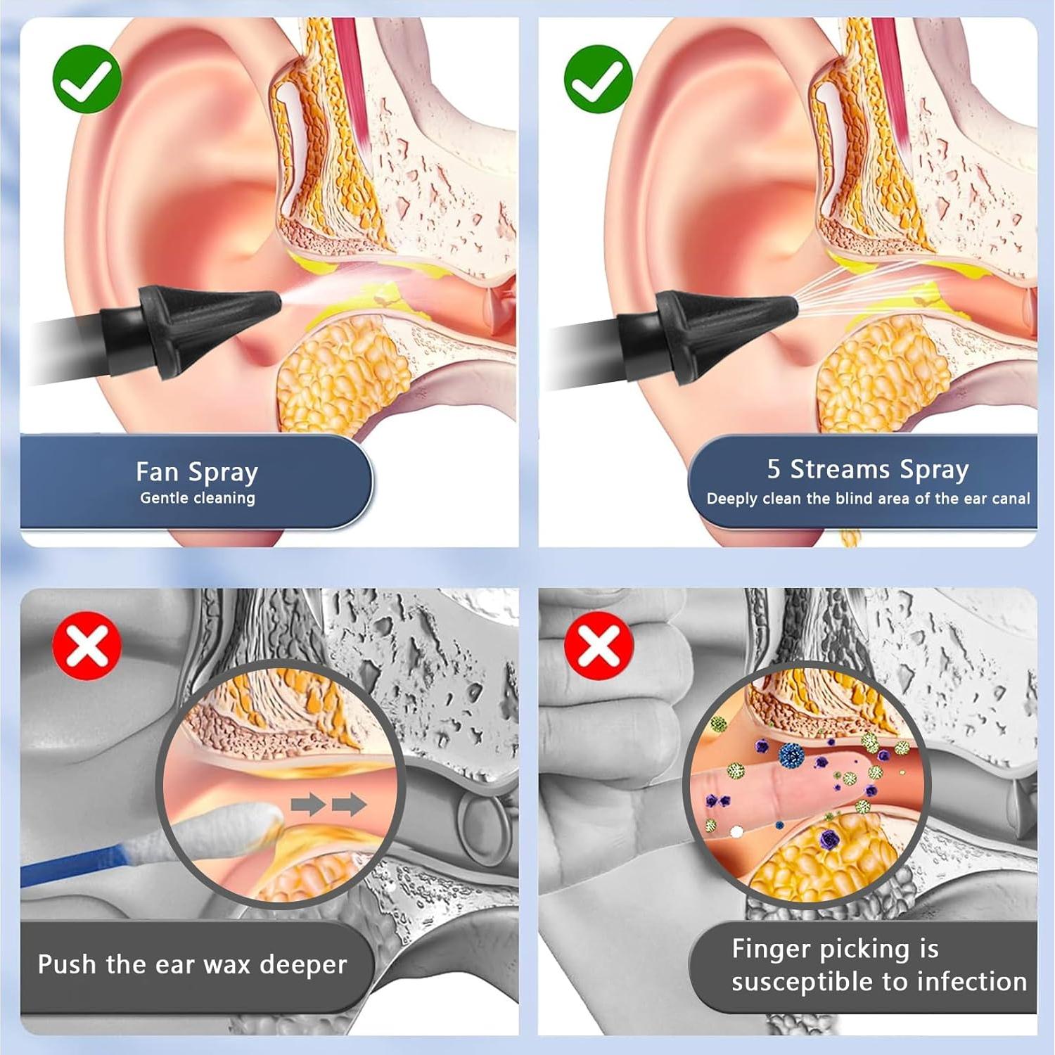 Limpiador de Oídos Eléctrico OMEDIC OME02 con 4 Modos de Presión
