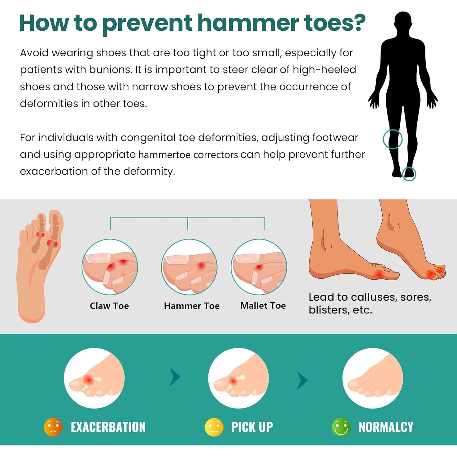 Corrector de Dedo en Martillo Welnove - 6 Férulas de Gel Suave