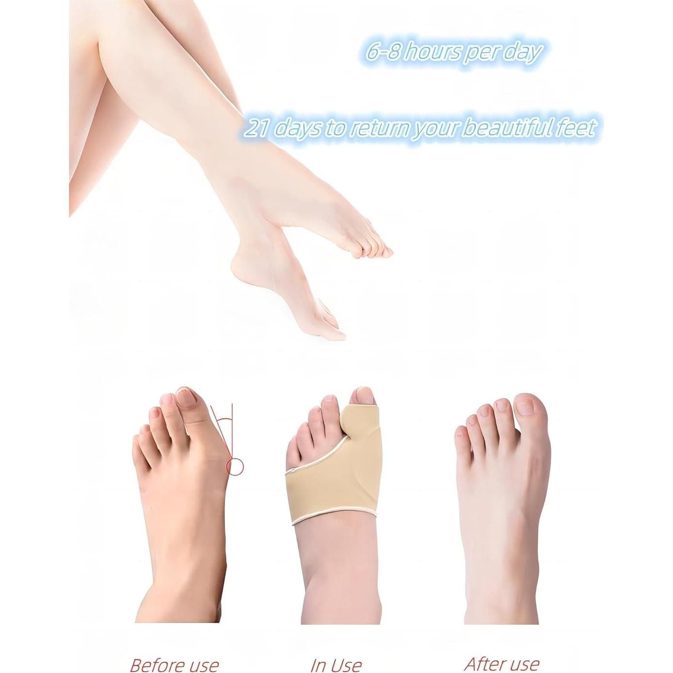 Corrector de Juanetes KAEZDD con Almohadillas de Gel - Talla S