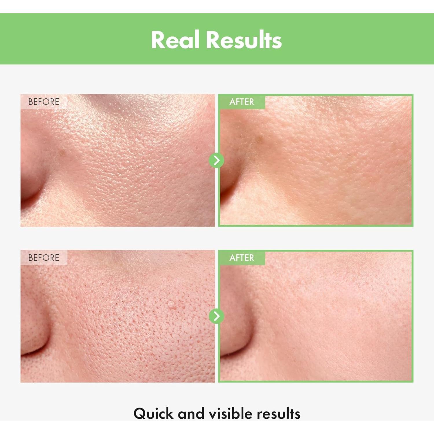 Ampoule de Poros MANTONG Tomate Verde 30ml Hidratante Facial