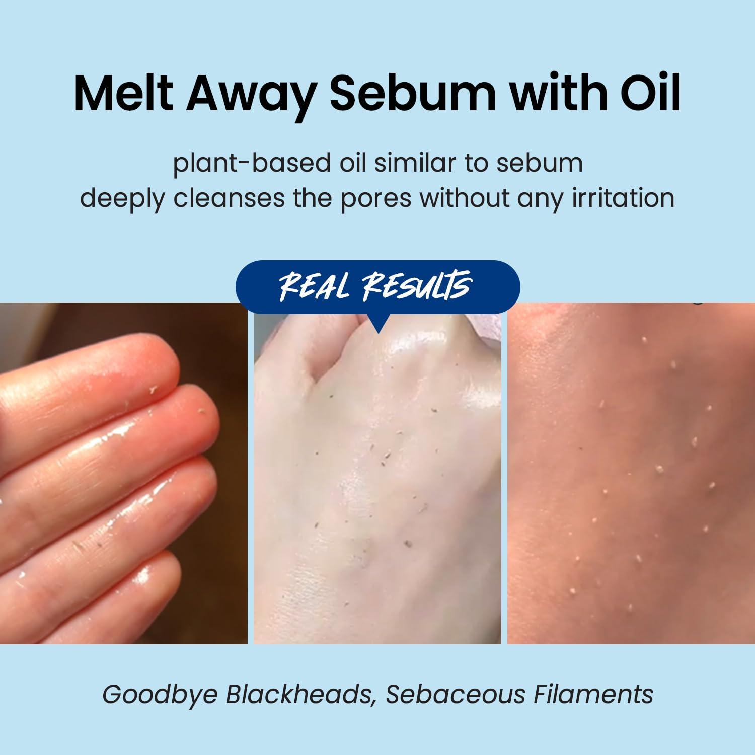 Coxir Limpiador Facial Aceite Hialurónico 150ml Suave