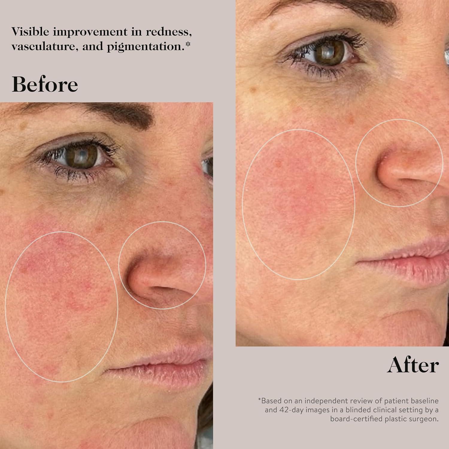 Suero de Péptidos Goop Beauty 30 ml Antienvejecimiento