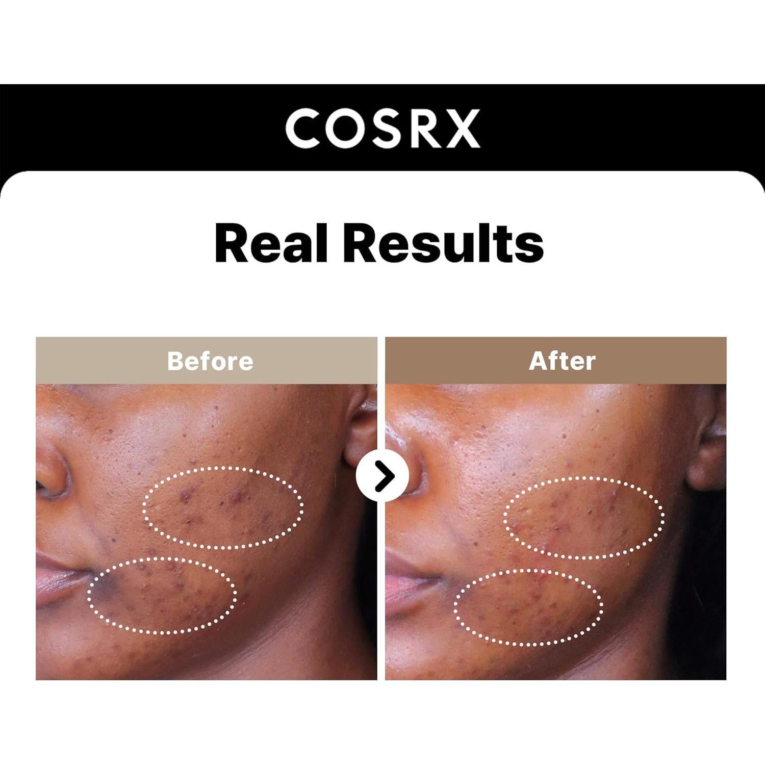 Suero Facial COSRX 2% Alpha Arbutin 50 ml - Cuidado de Manchas