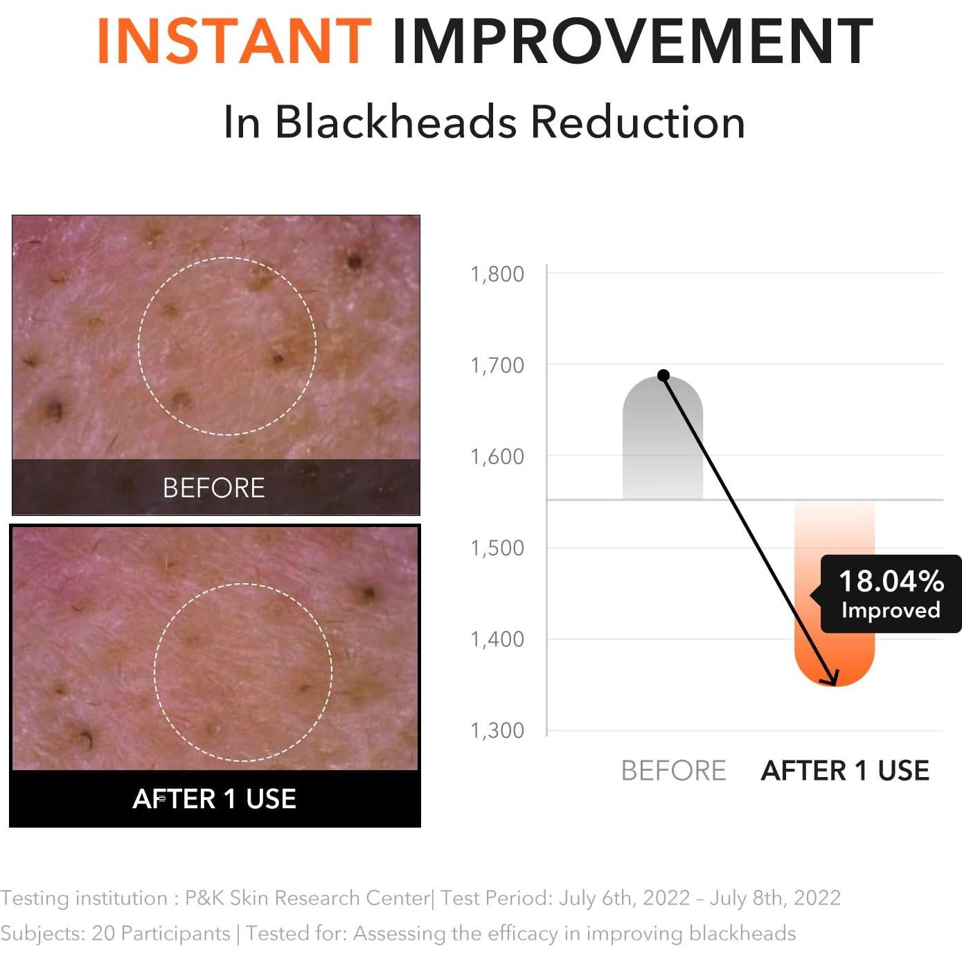 Bálsamo Limpiador APRILSKIN Carrotene 90 ml Piel Sensible