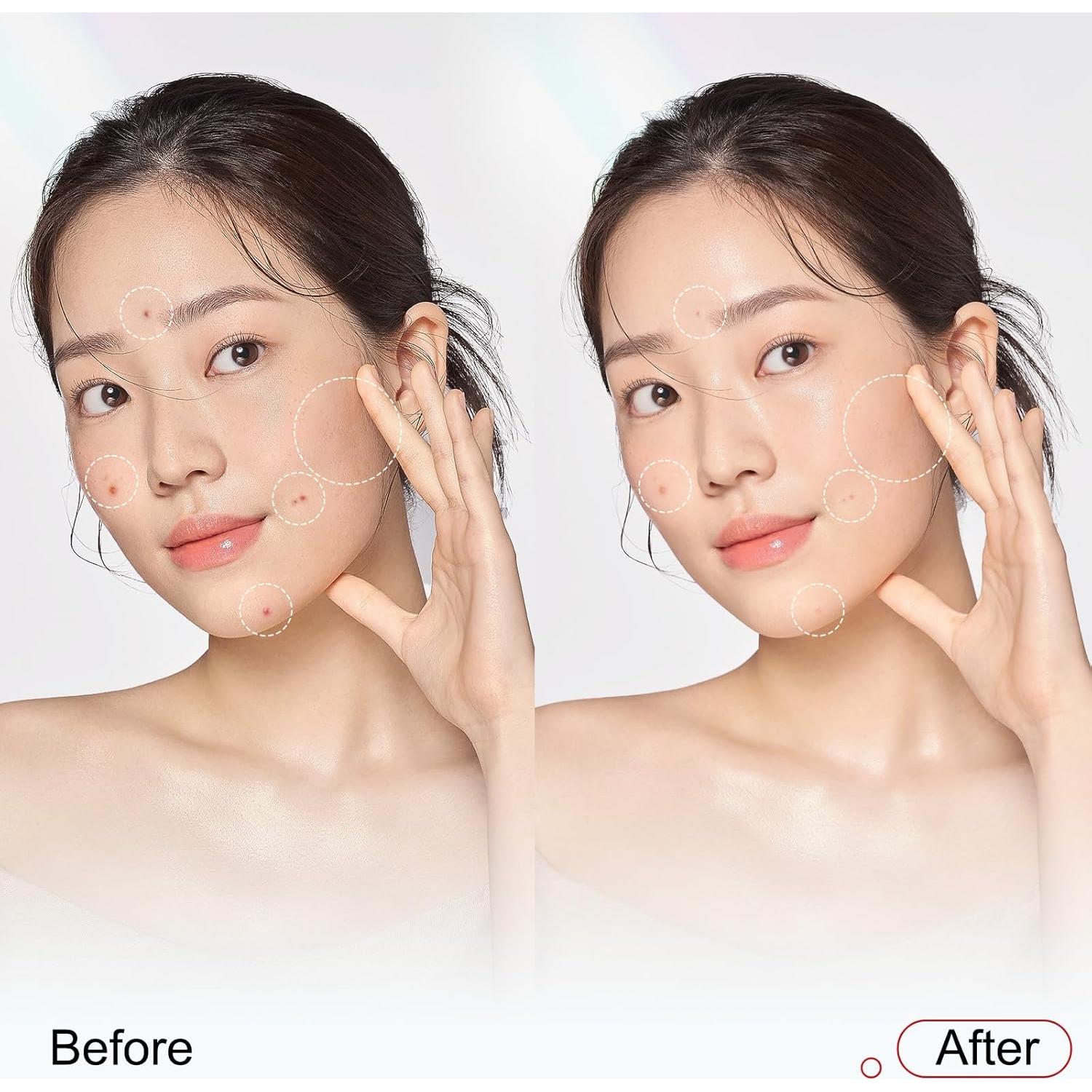 Suero Facial Niacinamida 10% ZMbeauty 30ml Hidratante