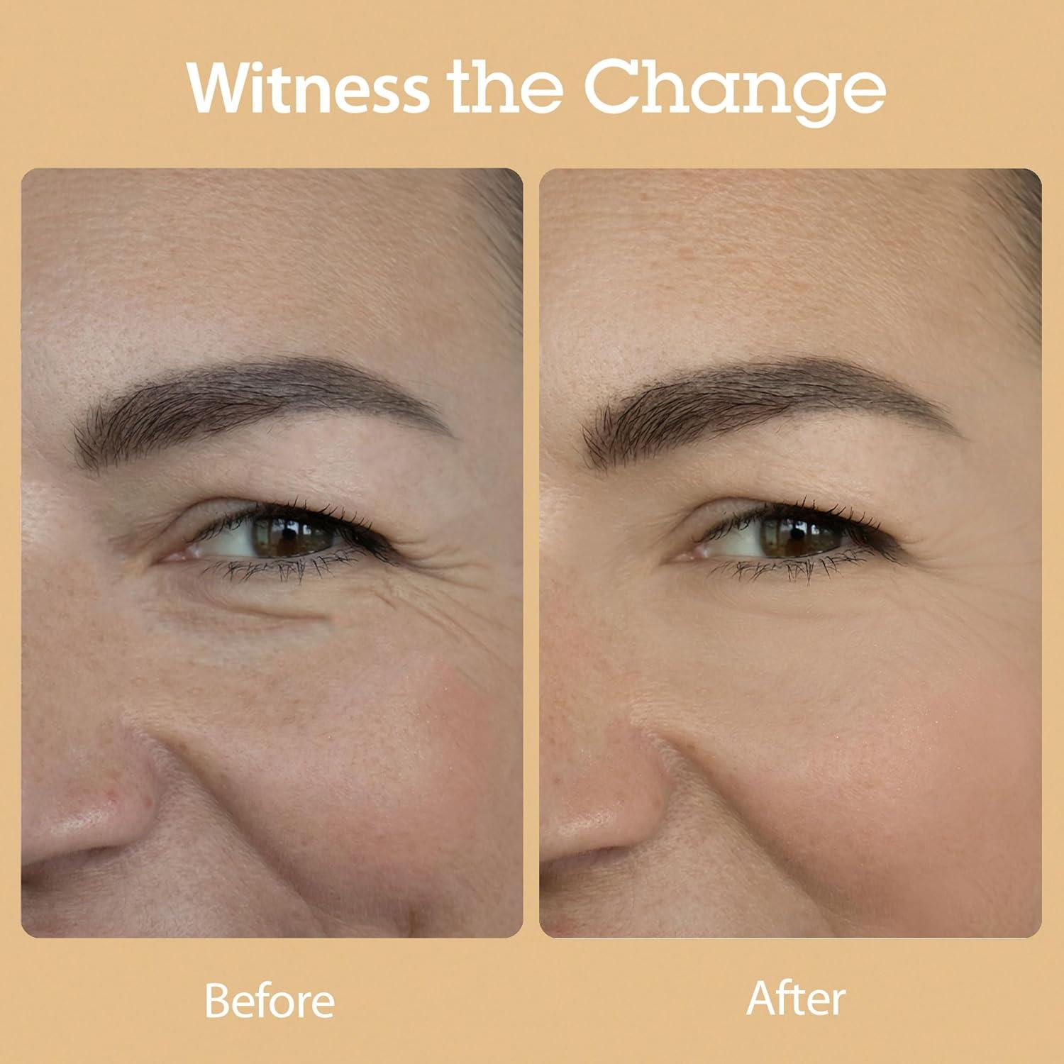 BLITHE Esencia Clara 8 Frijoles 150 ml Hidratante Facial