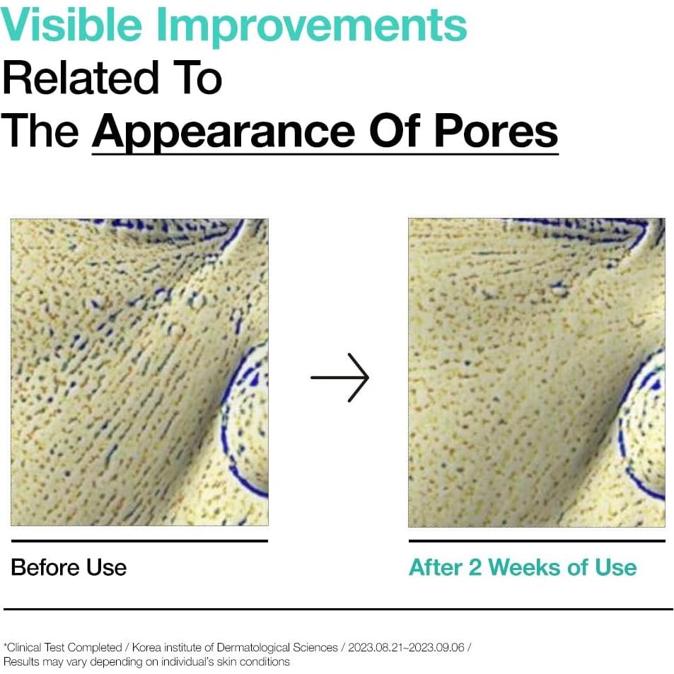 Tónico Exfoliante Suave ANUA BHA 2% 150ml - Ácido Salicílico