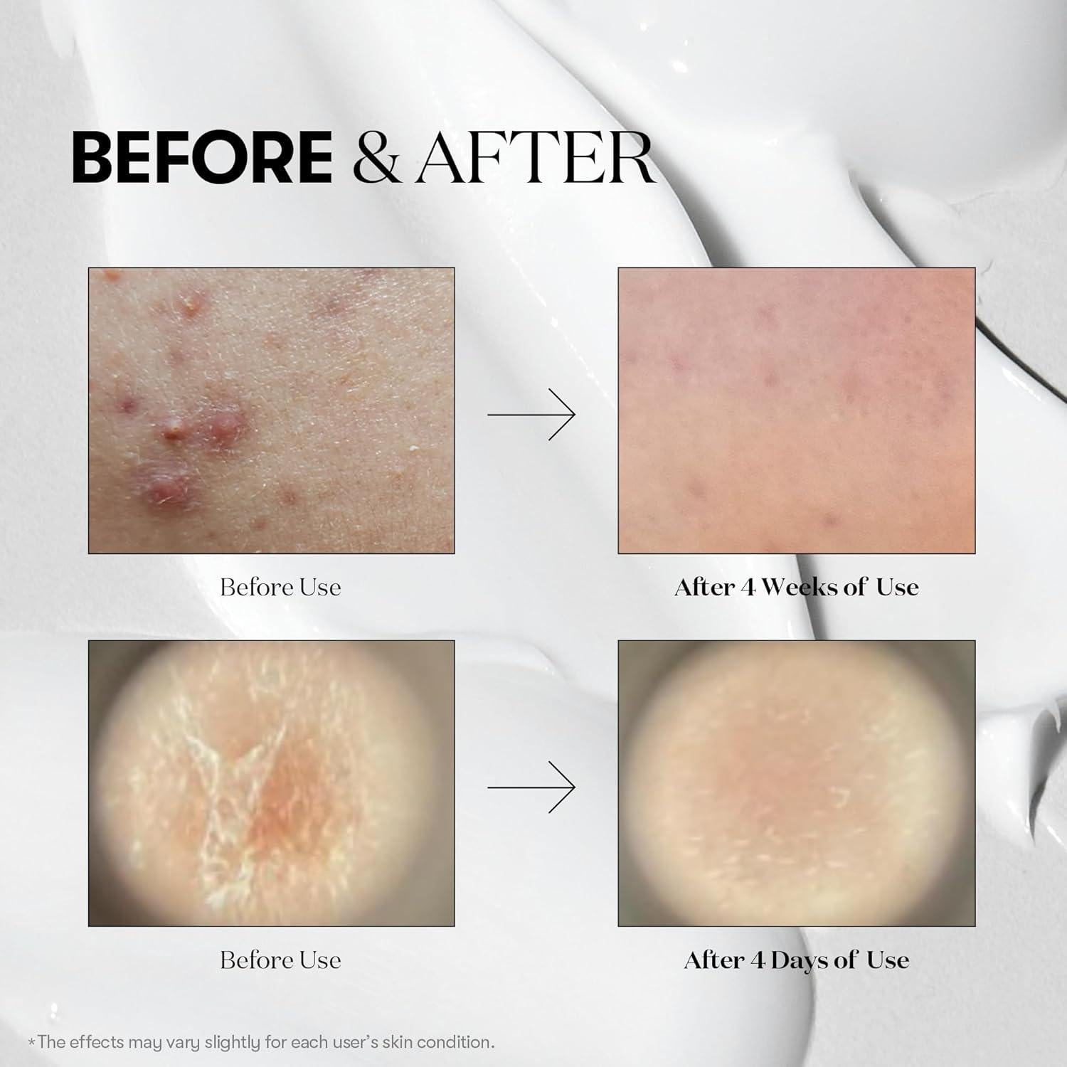 VT COSMETICS Reedle Shot 100, Suero Microneedling 50ml