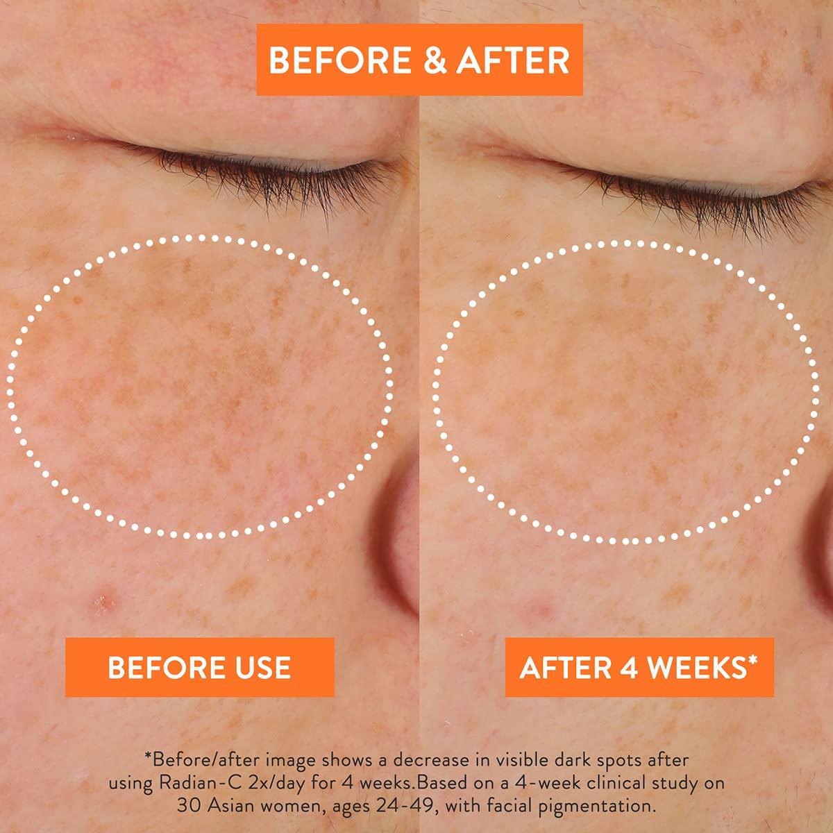 Crema Radian-C LANEIGE 50ml Vitamina C y E Aclara Manchas