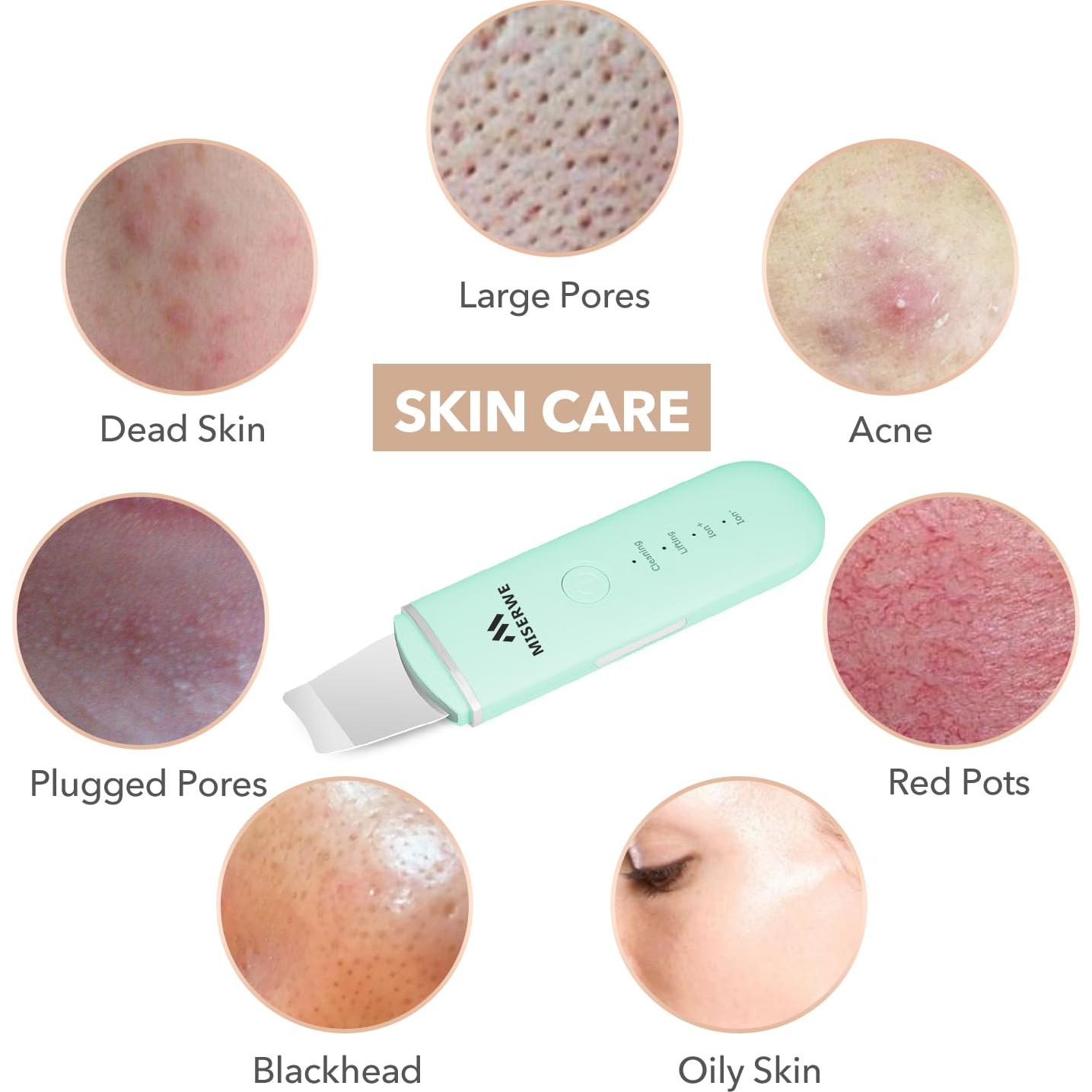 Espátula Facial Limpiadora Miserwe Skin Scrubber Verde 4 Modos