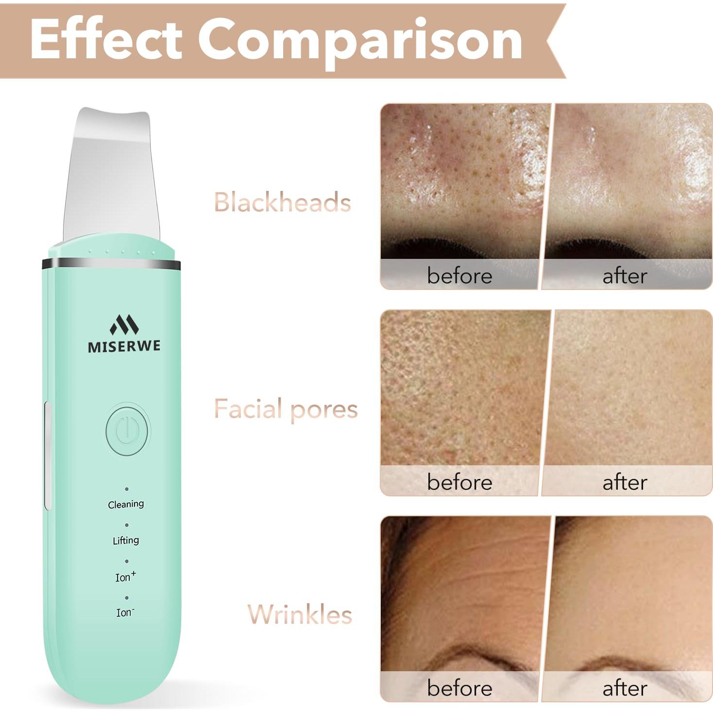 Espátula Facial Limpiadora Miserwe Skin Scrubber Verde 4 Modos