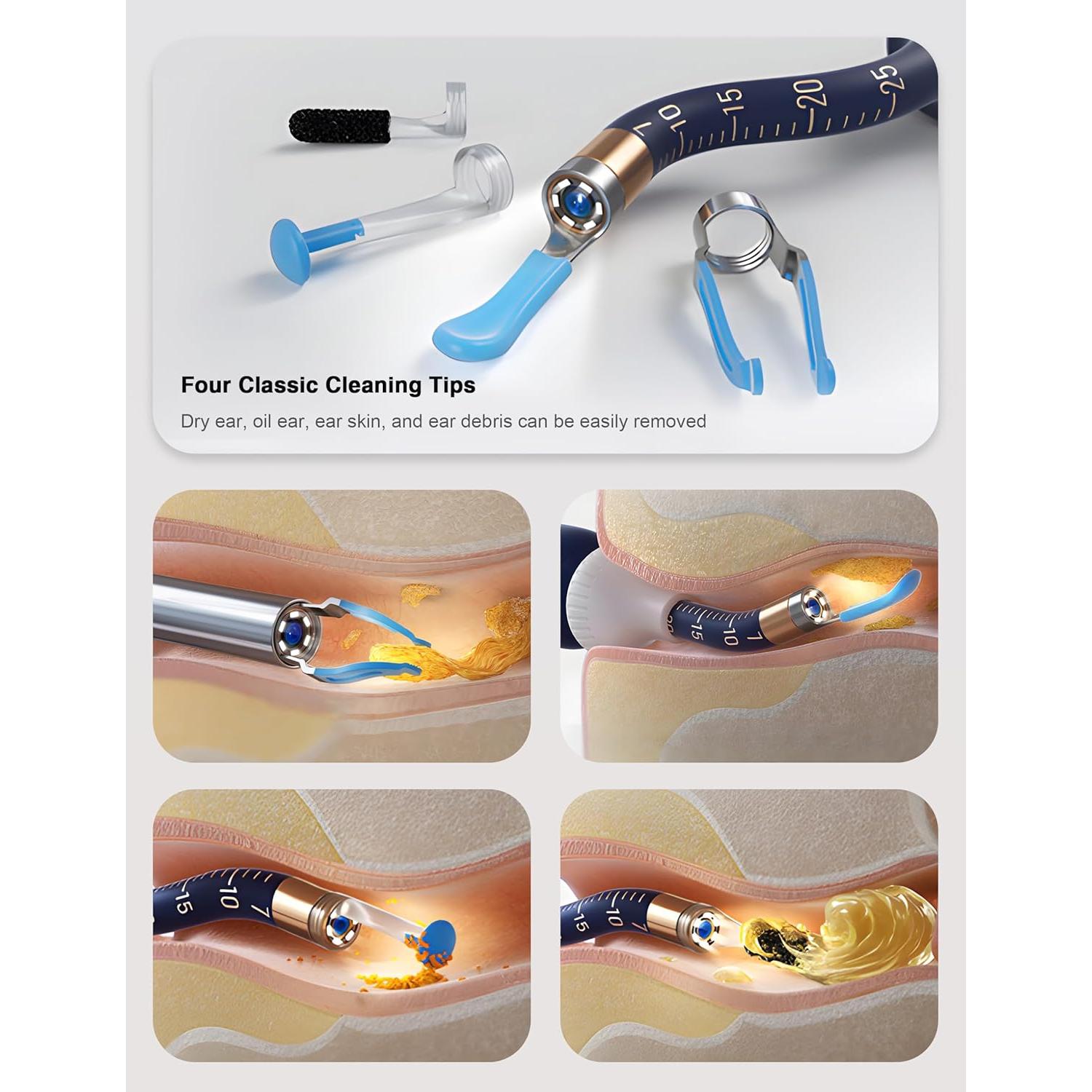 BEBIRD Earsight Plus Kit Limpiador de Cerumen HD WiFi Azul