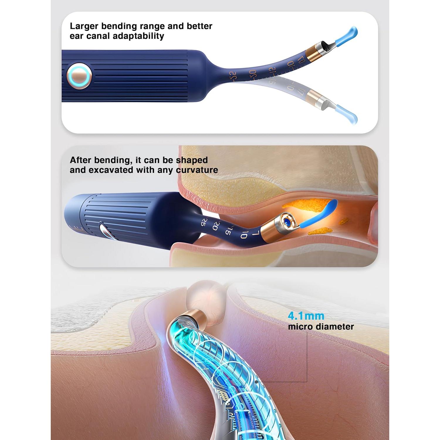 BEBIRD Earsight Plus Kit Limpiador de Cerumen HD WiFi Azul