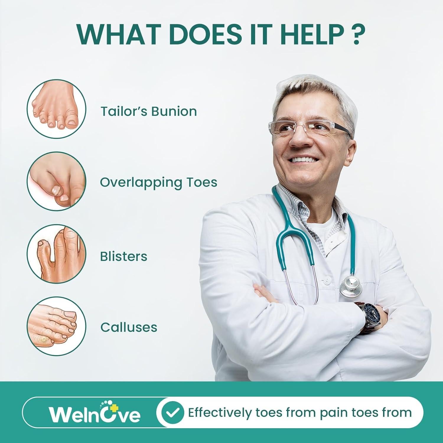 Protectores de Bunion Welnove - 8 Piezas Beige para Alivio