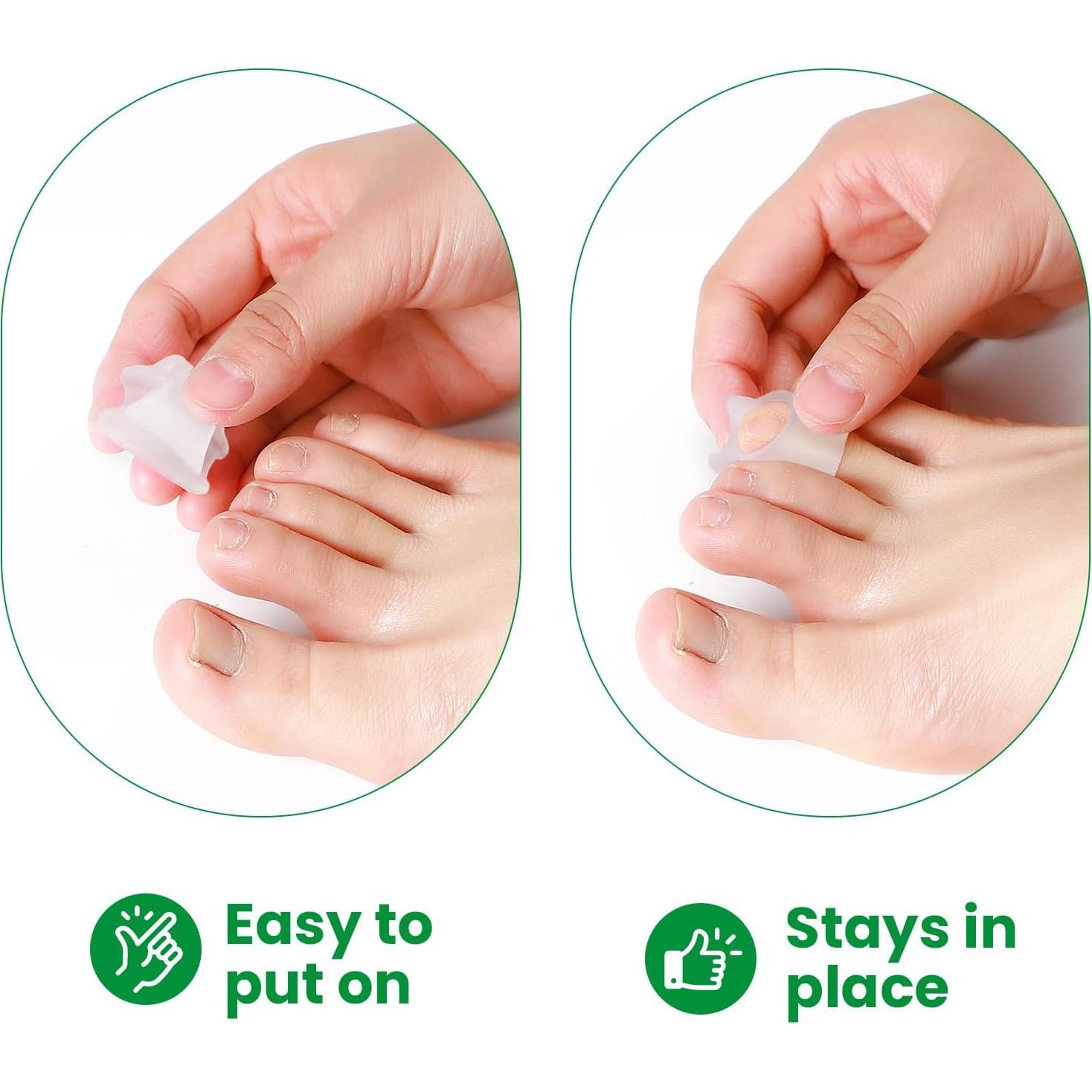 Corrector de Dedo en Garra Bukihome - 6 Paquetes Pequeños