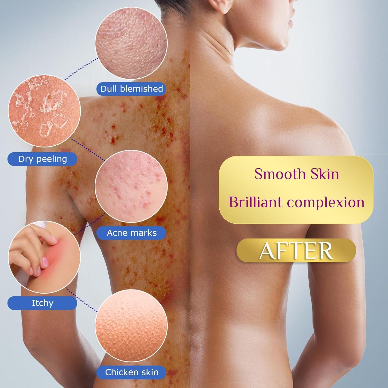 Esponja de Red Africana SpiralScgv - Exfoliación Profunda 4 Piezas